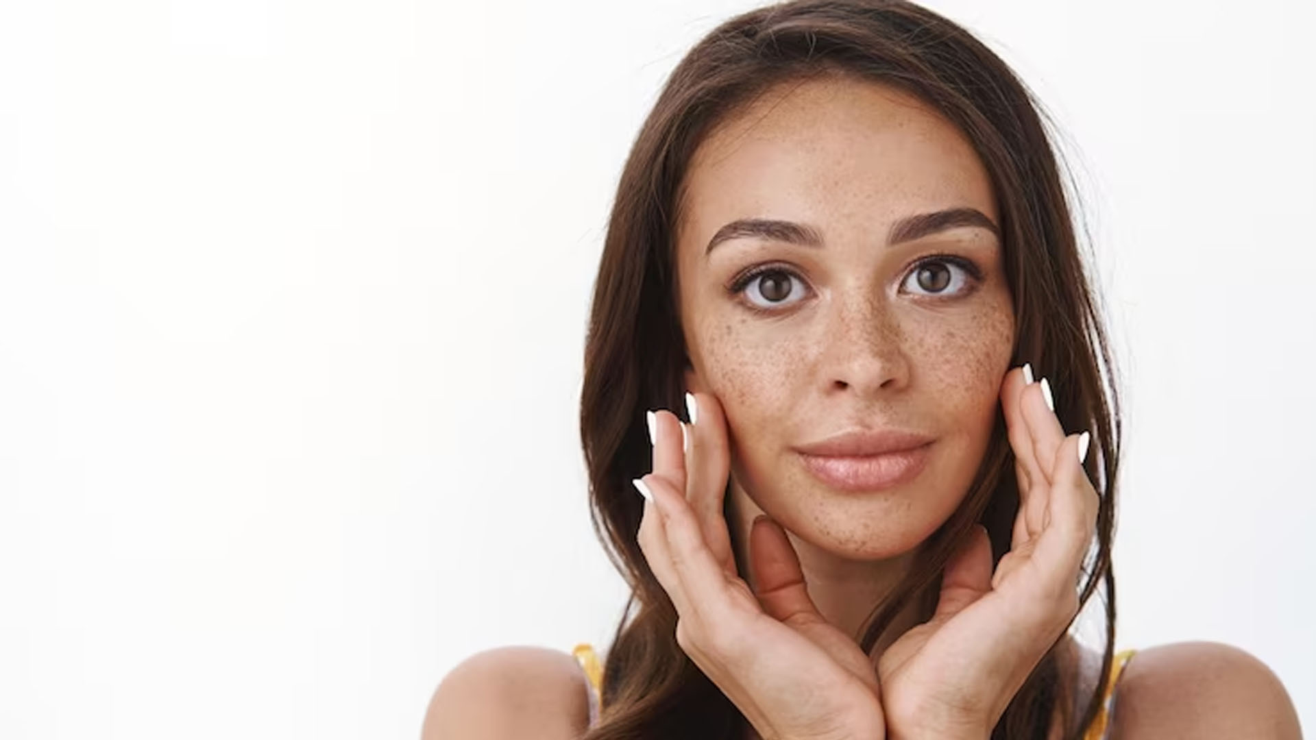 What are the Home Remedies to help with Hyperpigmentation?