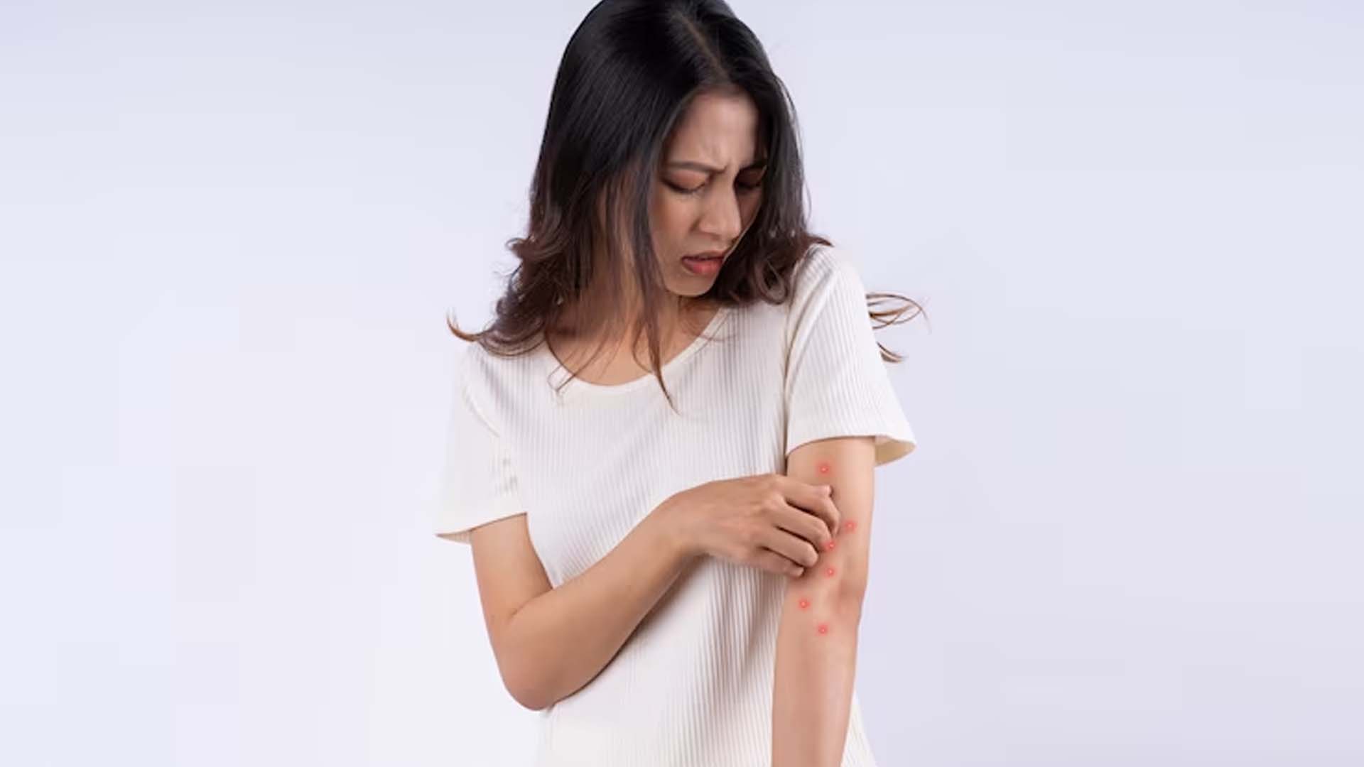 Women having Itchy Skin