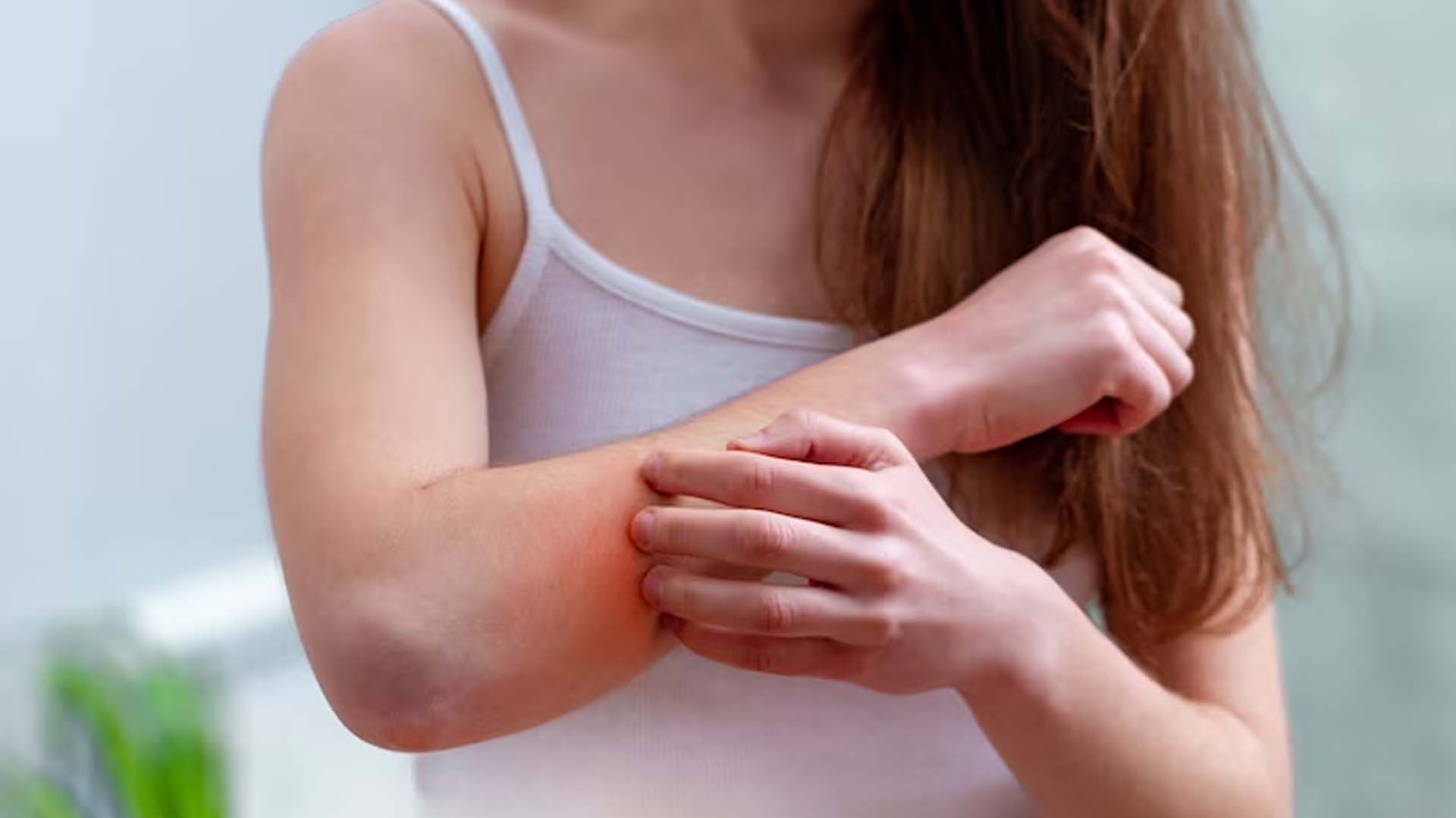 Itchy Skin