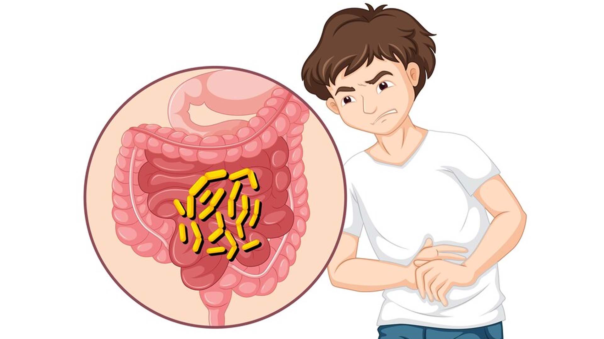 Worms in Stomach