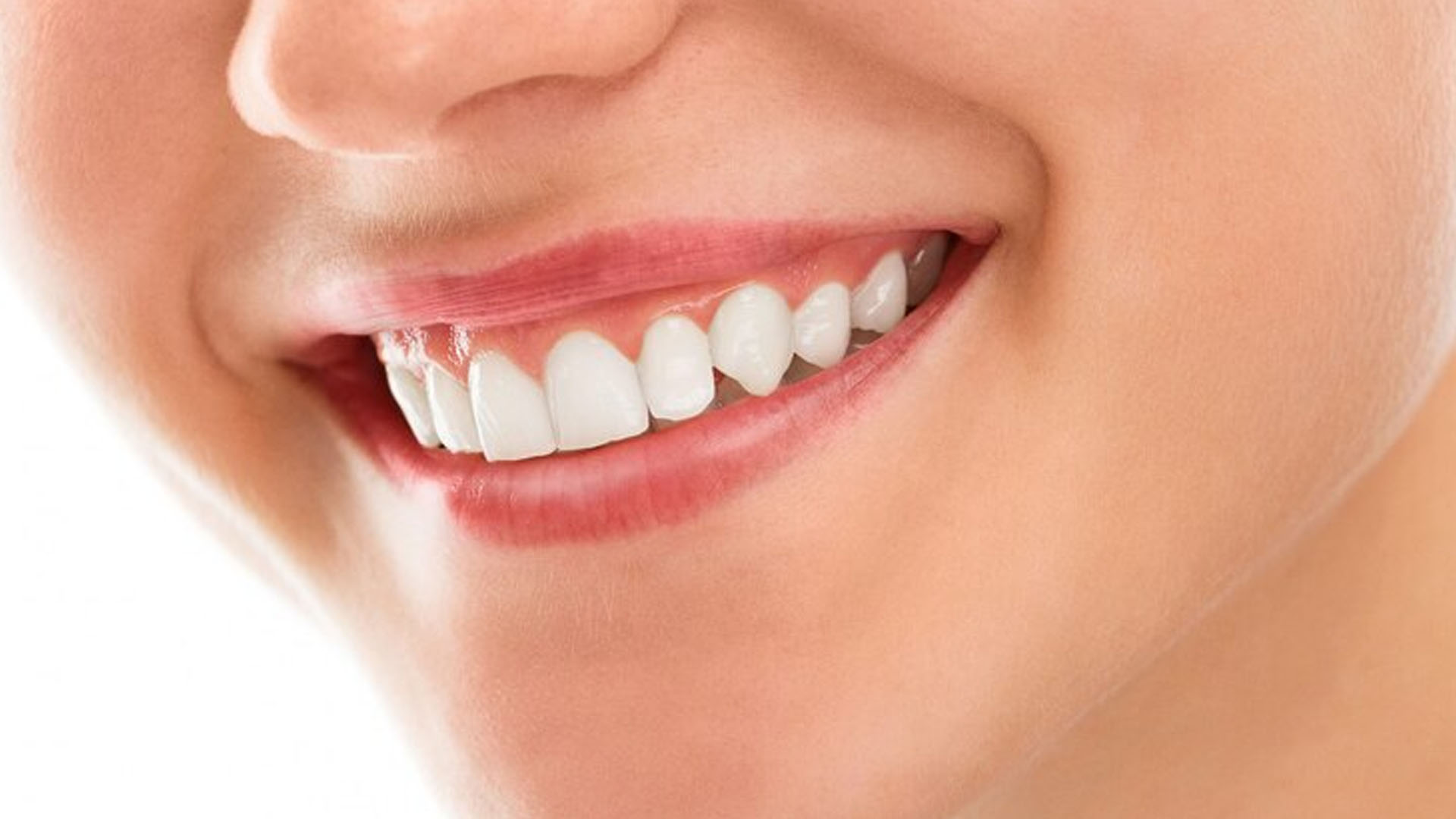 What are the Home Remedies for Teeth Whitening?