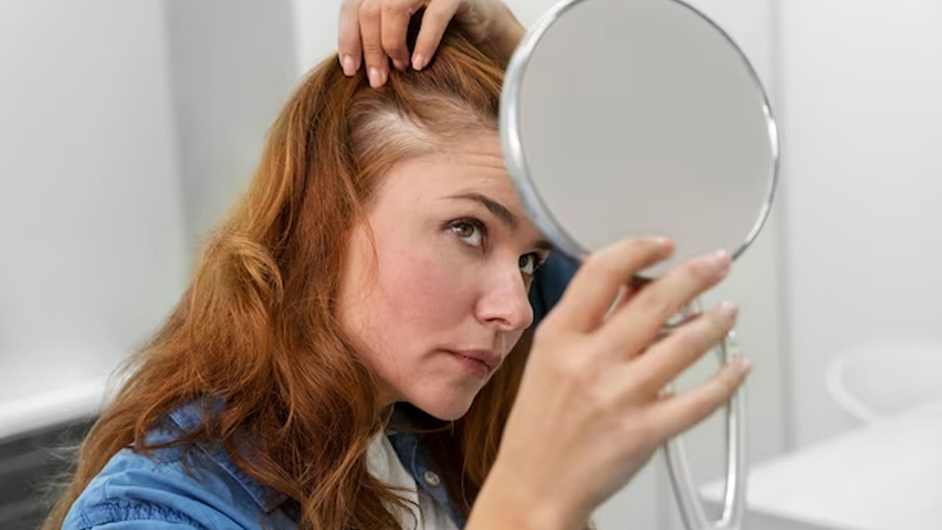 What are the Home Remedies for Alopecia Areate?