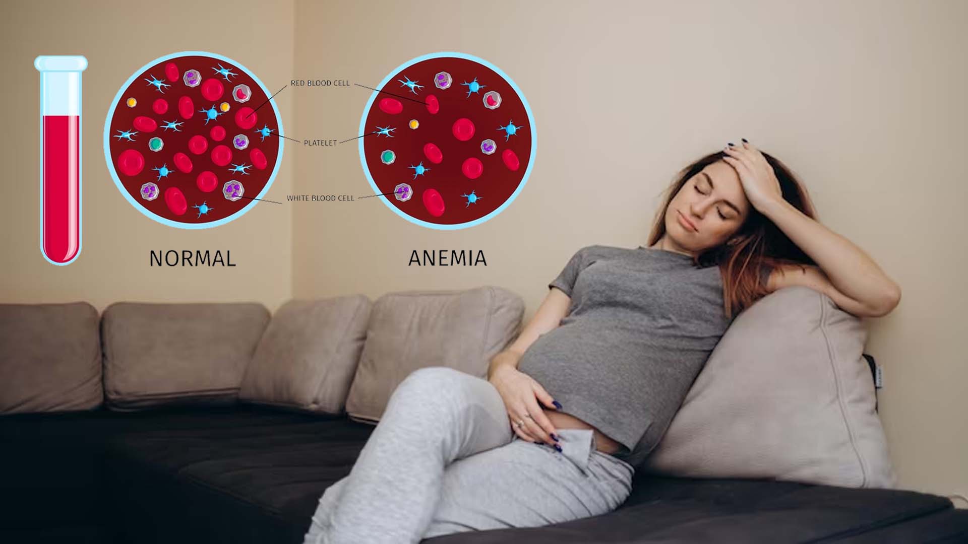 Anemia During Pregnancy
