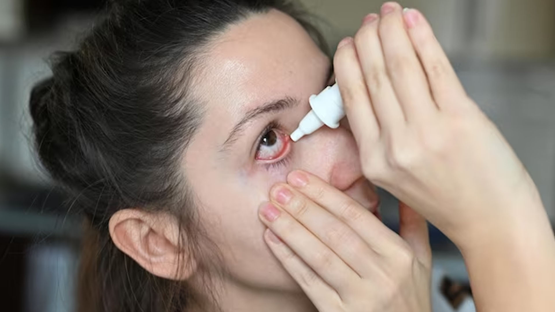 What are the Home Remedies for Blocked Tear Duct?