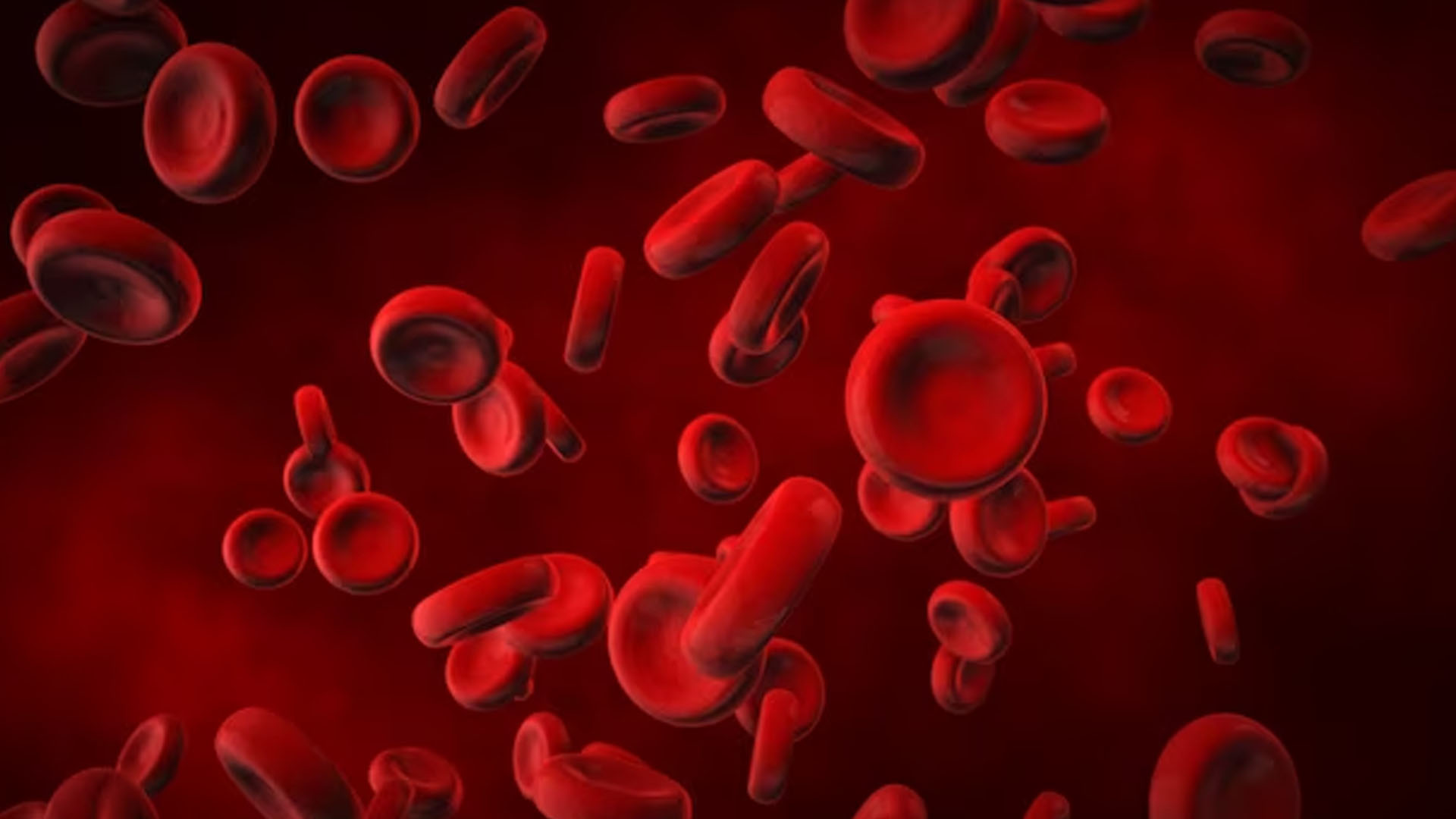 What are the Home Remedies to treat Blood Clots?