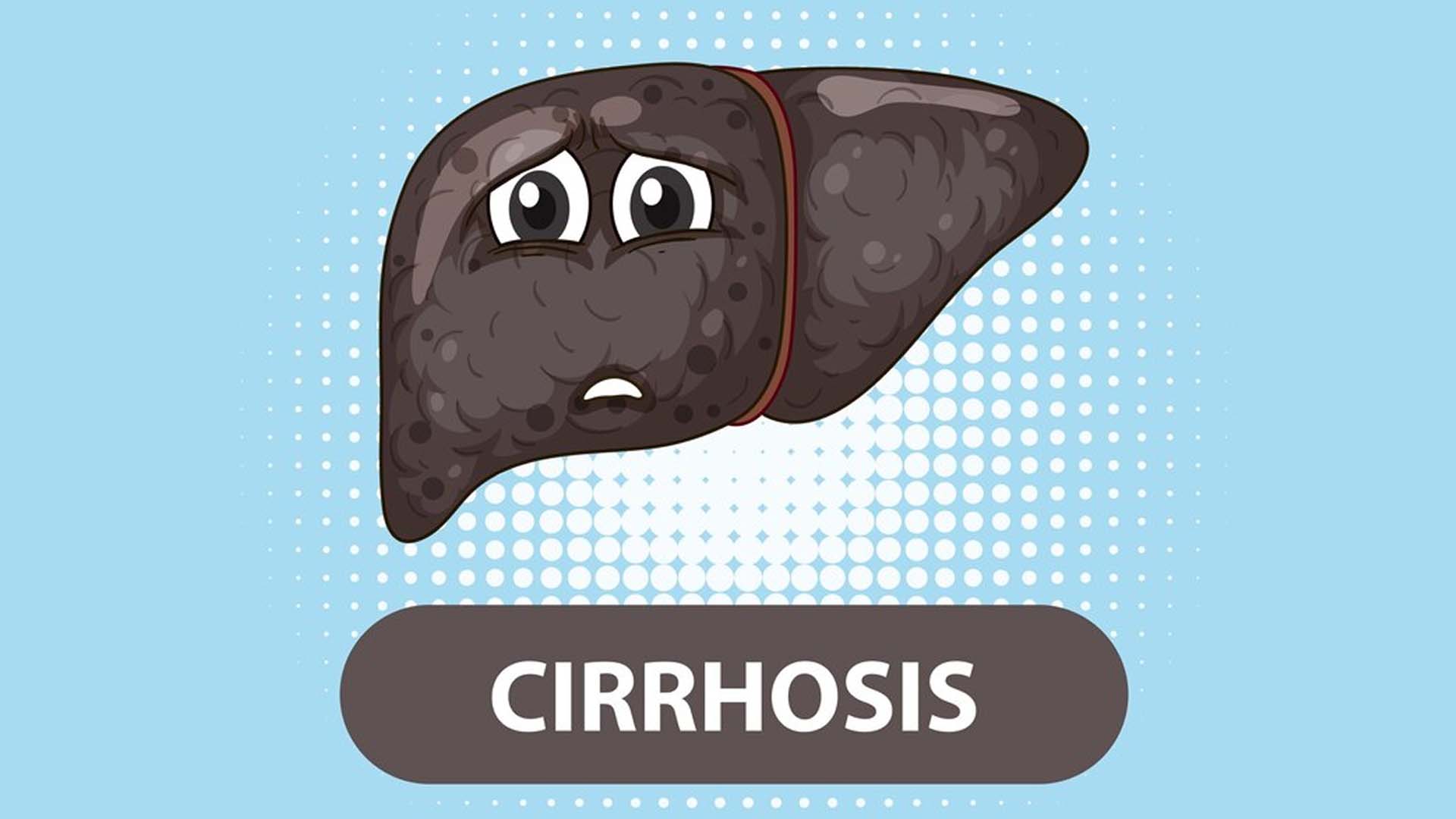 Cirrhosis