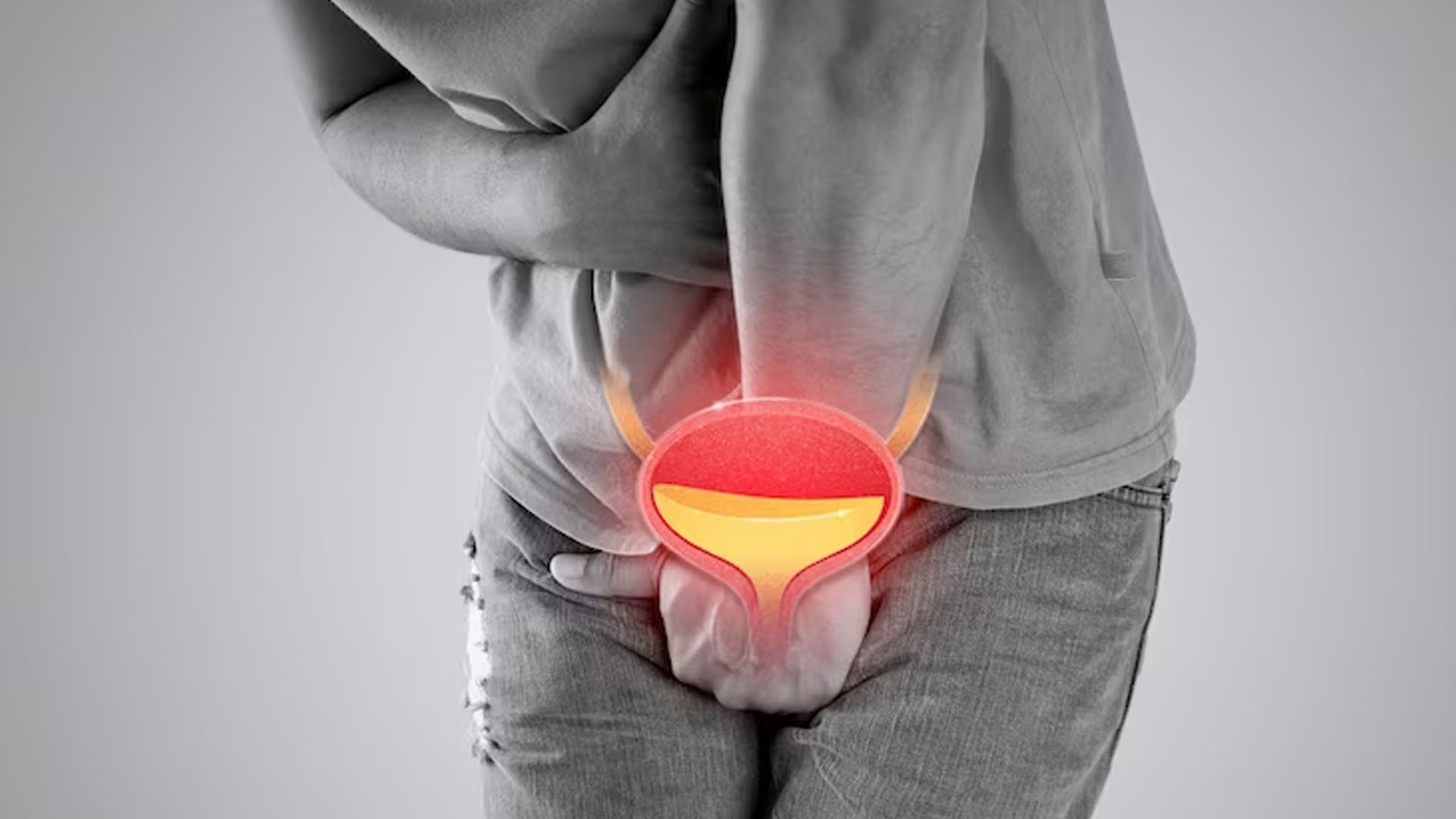 What are the Home Remedies for Cystitis?