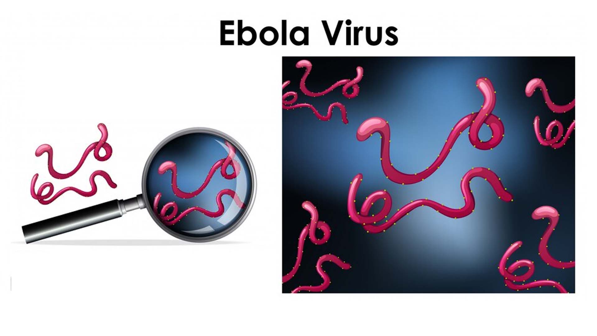 Ebola virus disease (EVD)