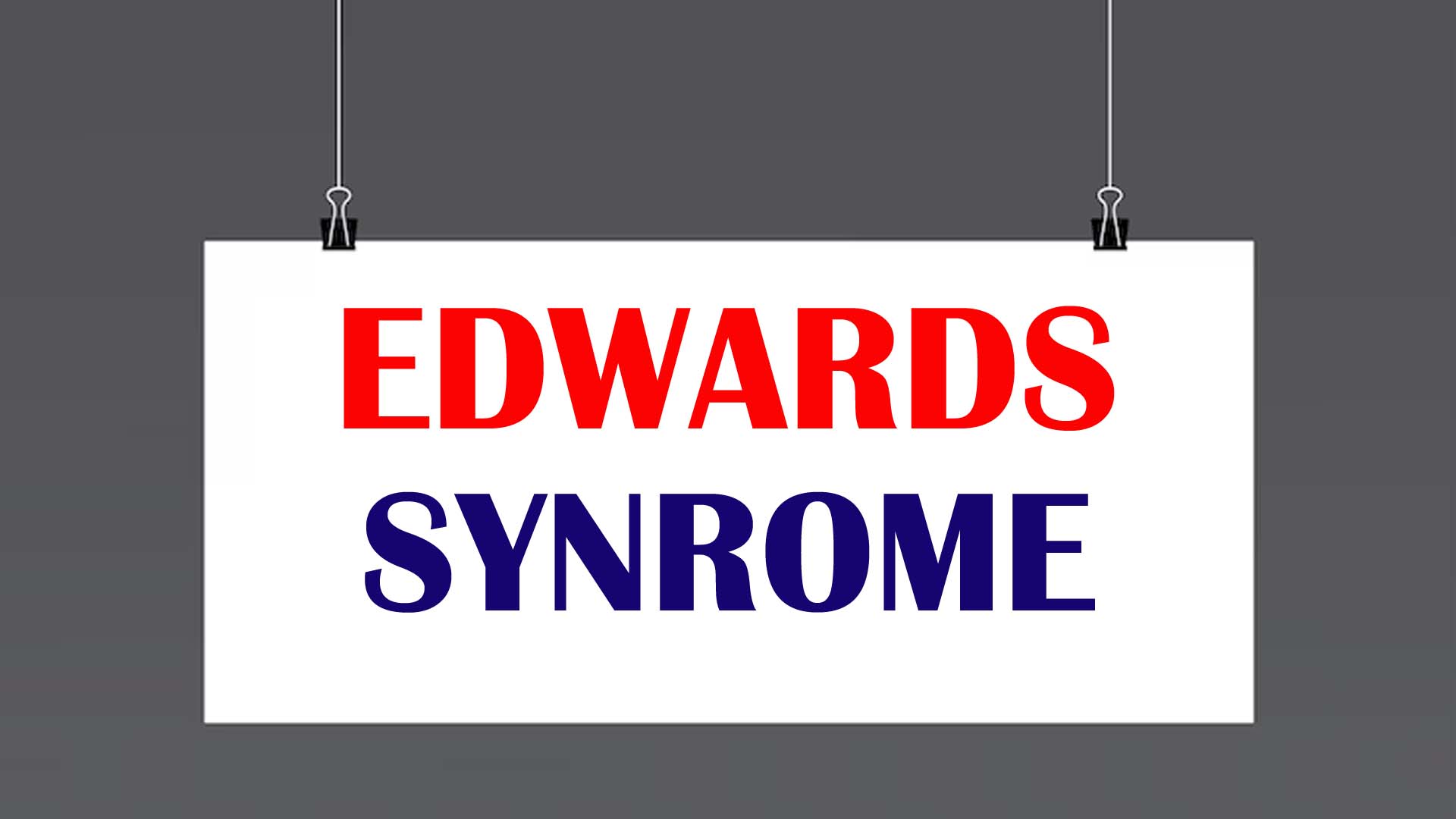 Edwards Syndrome