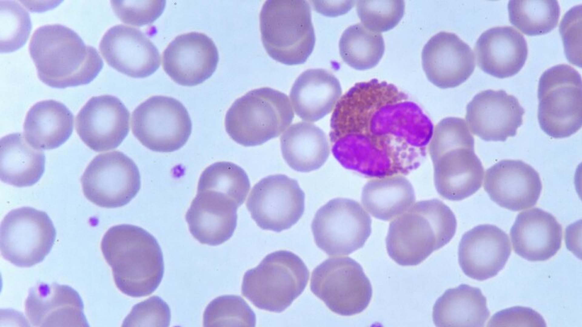 eosinophil cell