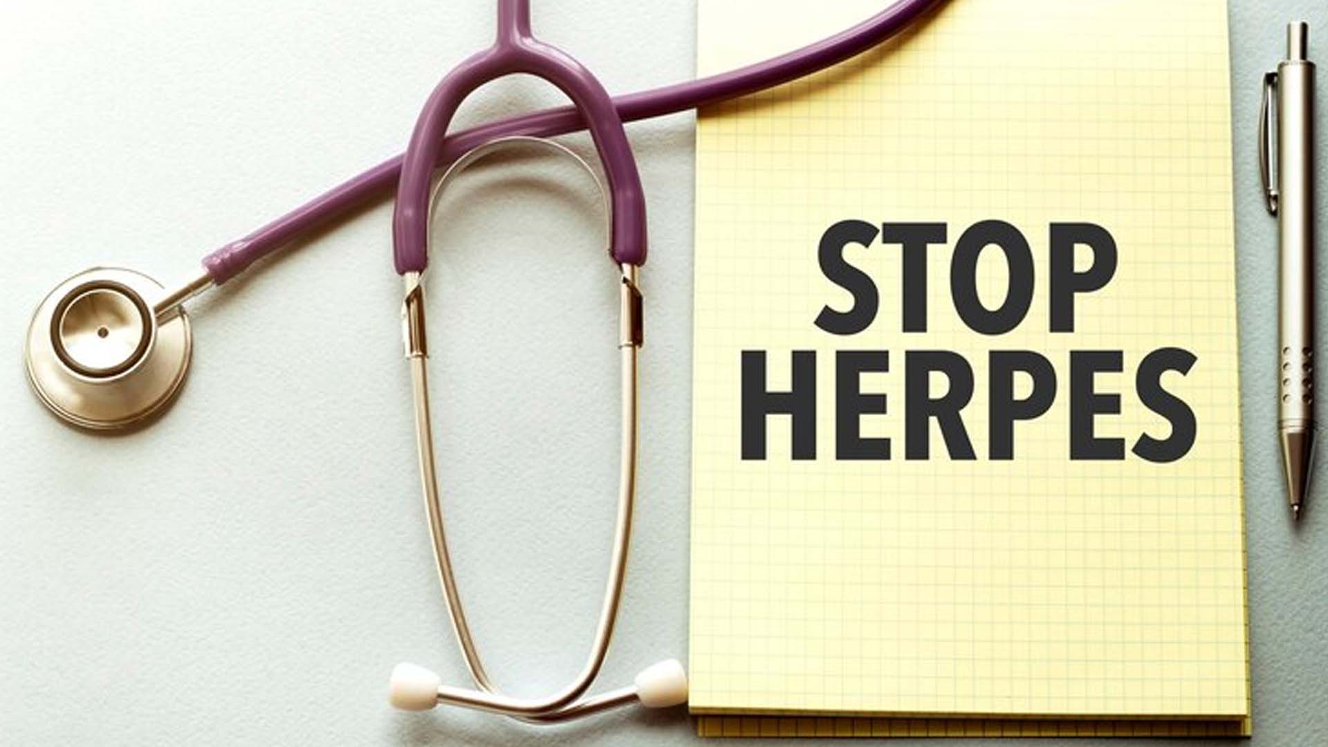 What are the Home Remedies for Herpes?