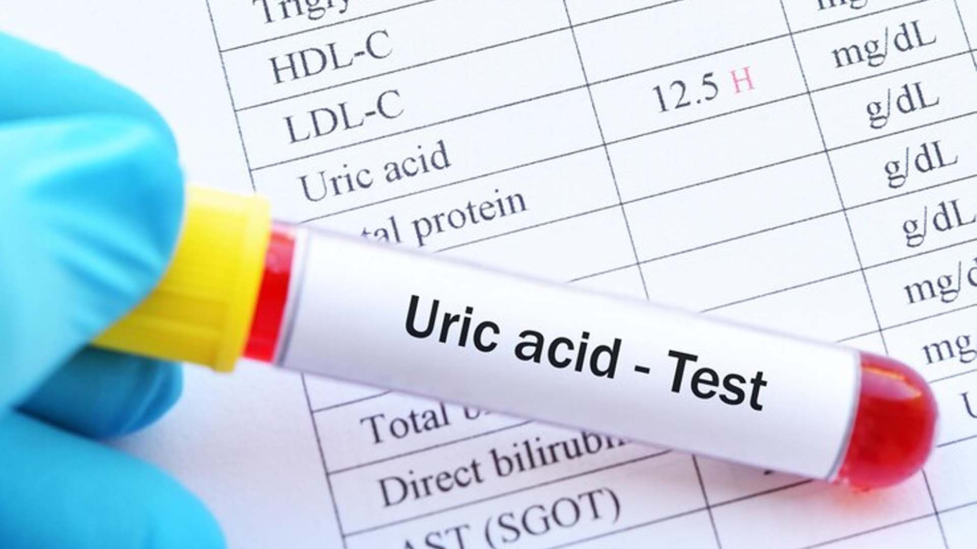 Excess uric acid in the blood