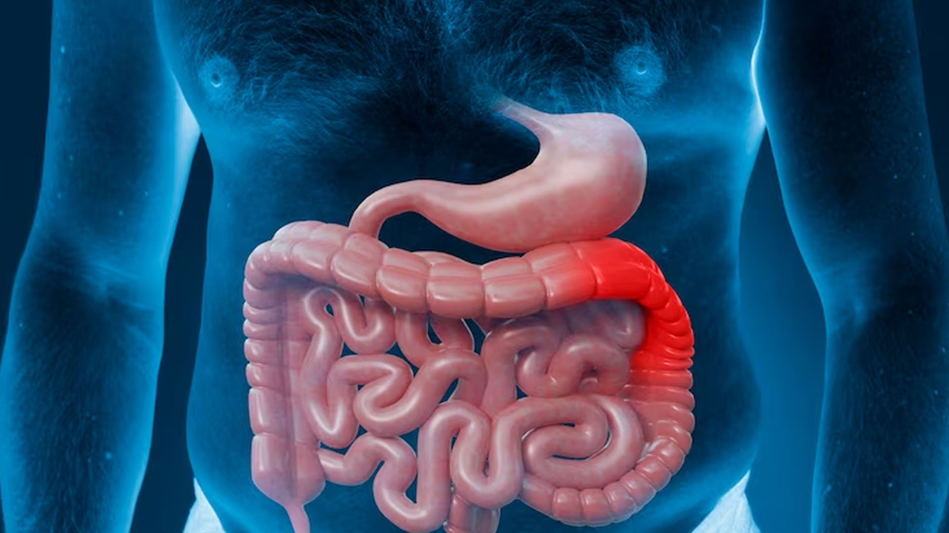What are the Home Remedies to cure IBS?