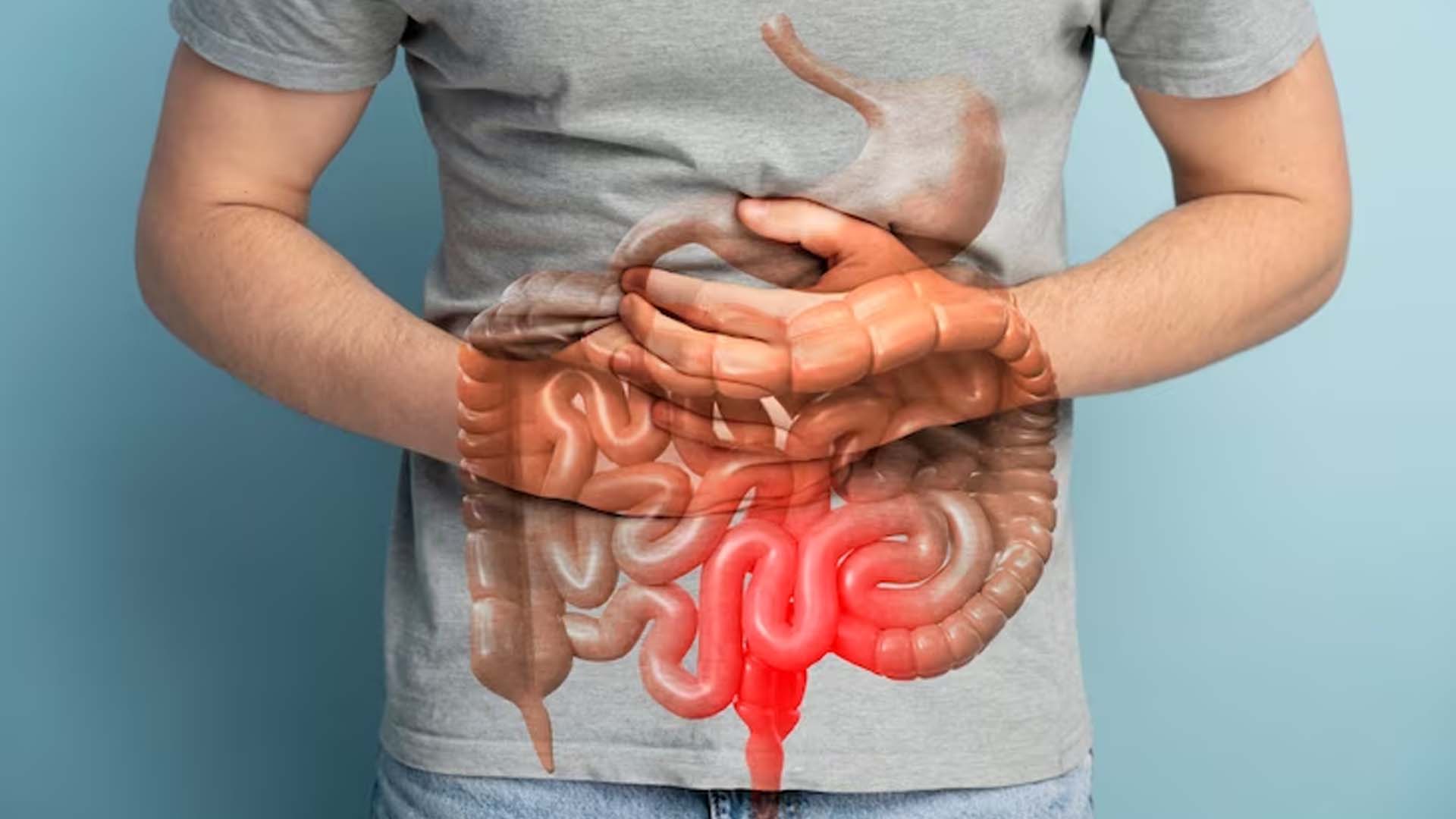 What are the Home Remedies for Irritable Bowel Syndrome (IBS)?