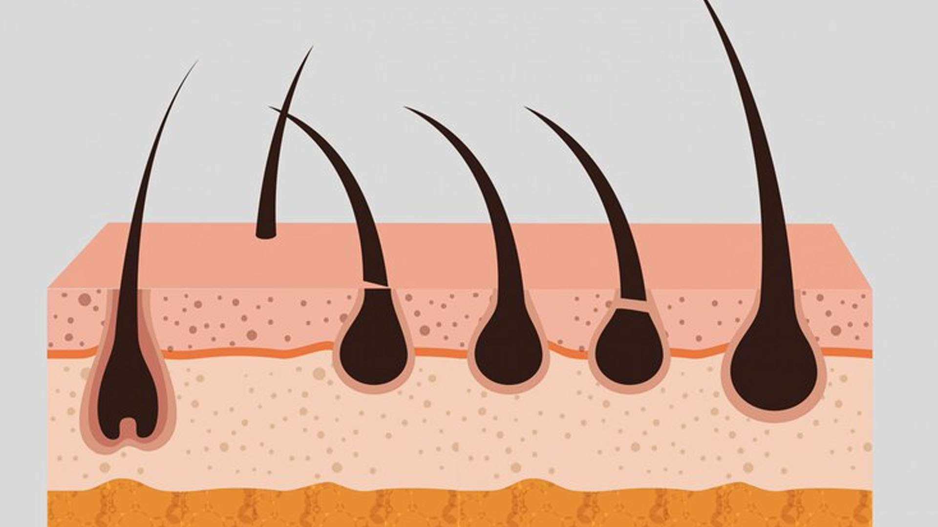 What are the Home Remedies for Ingrown Hair?