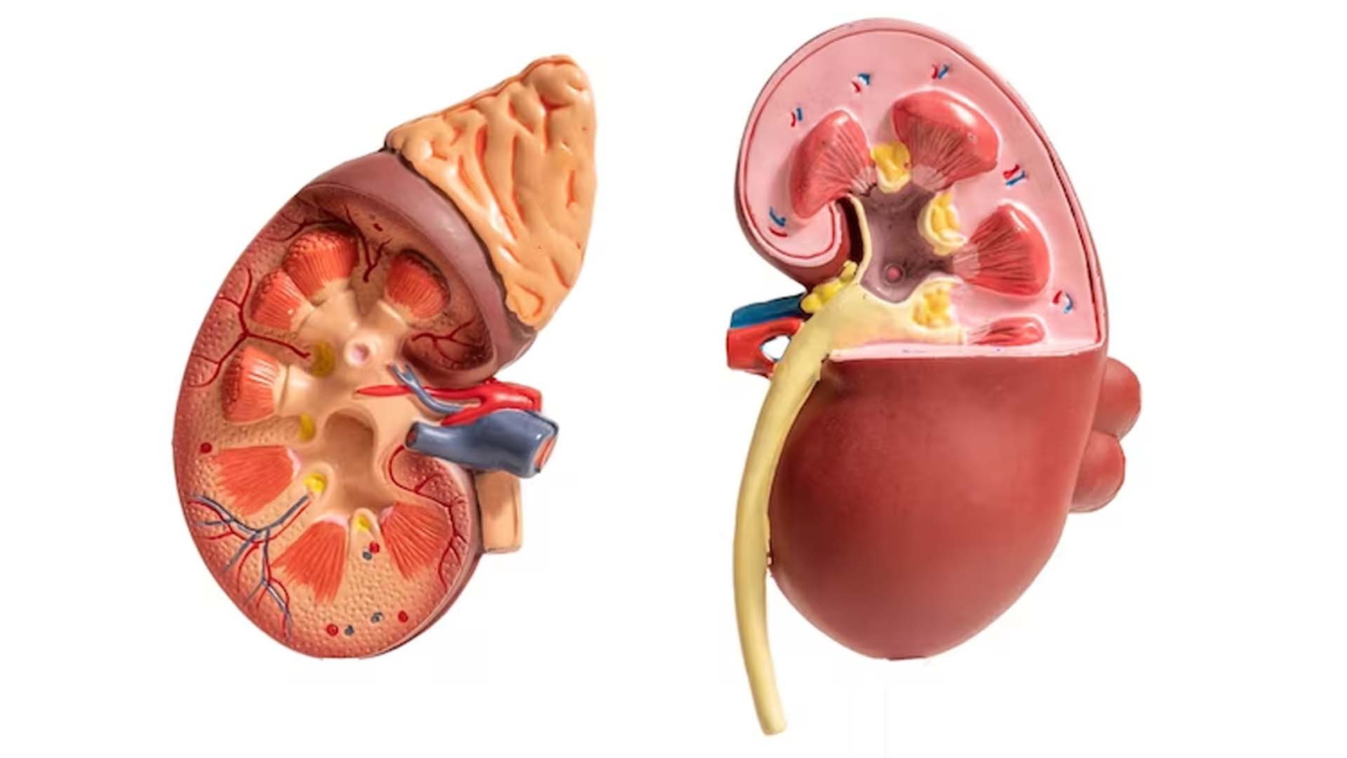 Kidney Damage