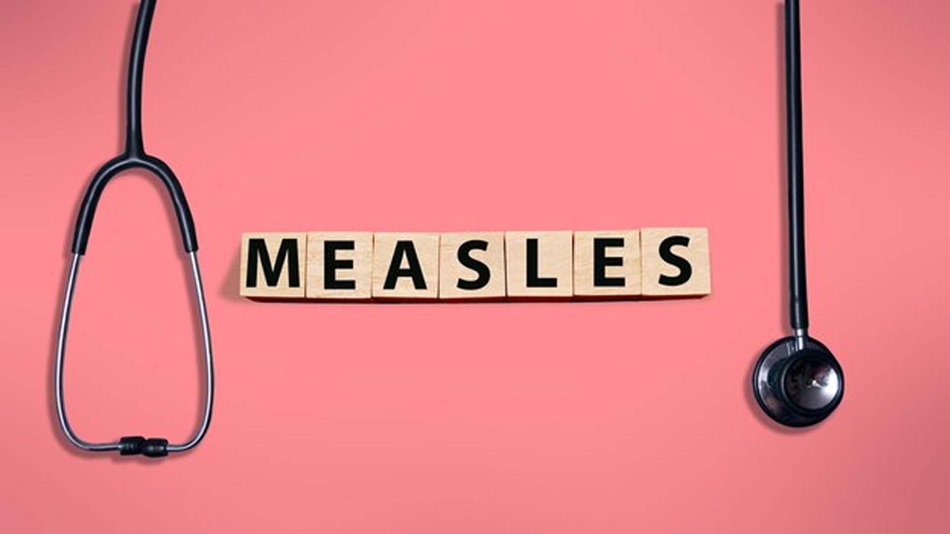 Measles