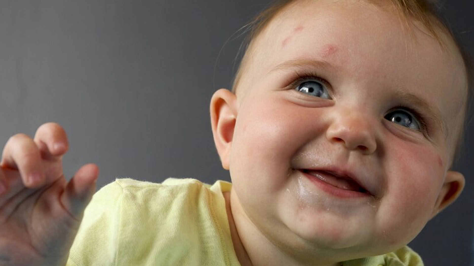 What are the Home Remedies for Milia in Infants?