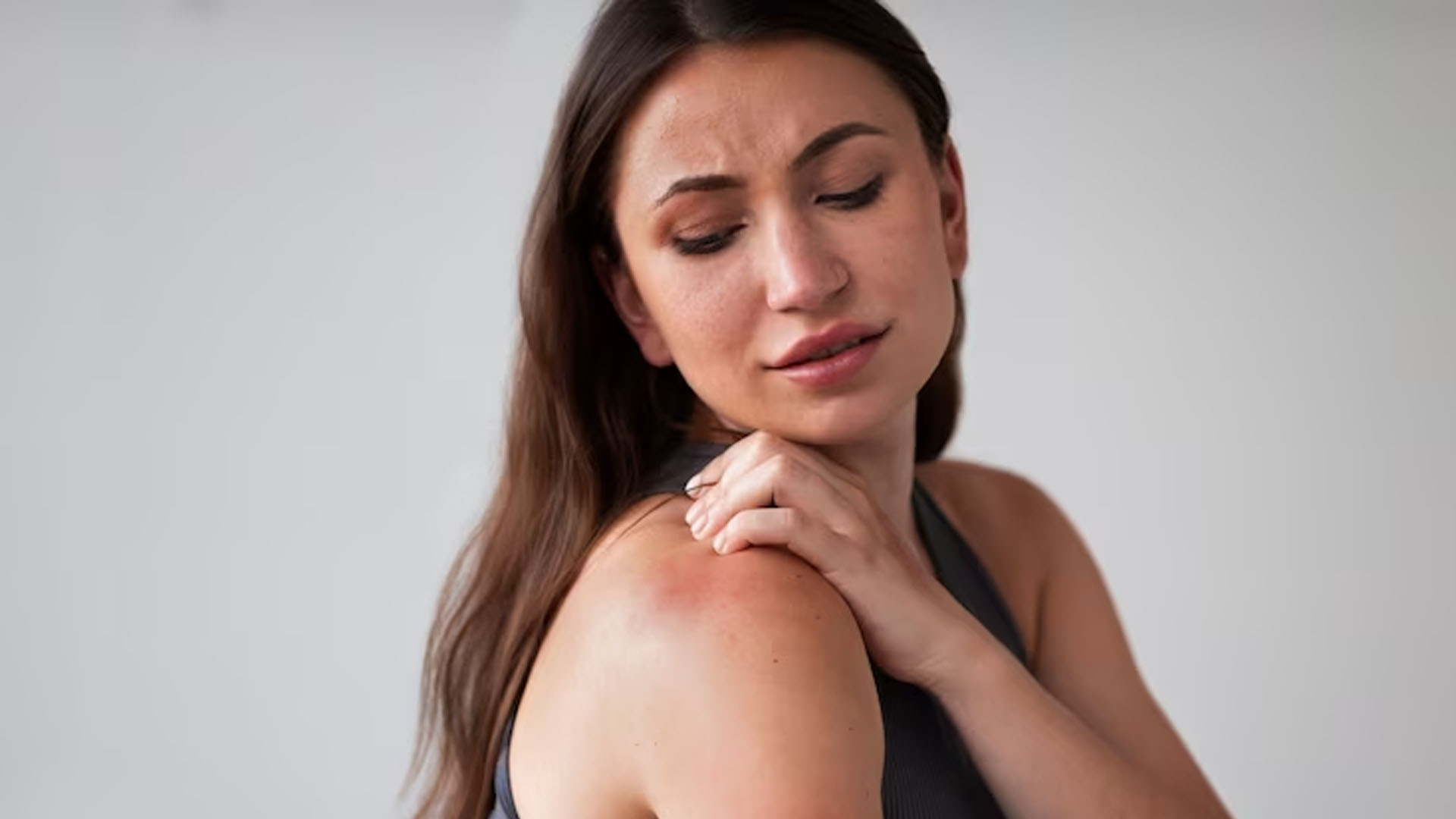 What are the Home Remedies for Prickly Heat?