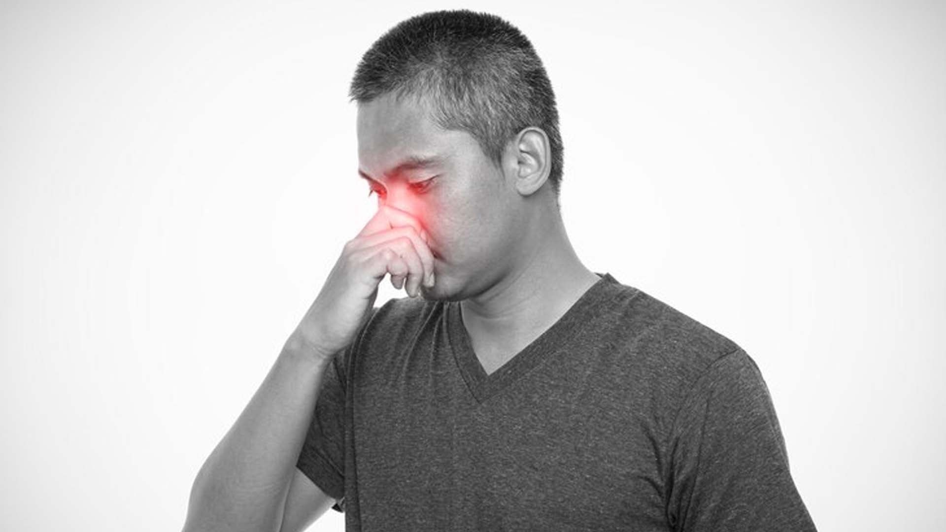 What are the Home Remedies for Pilonidal Sinus?