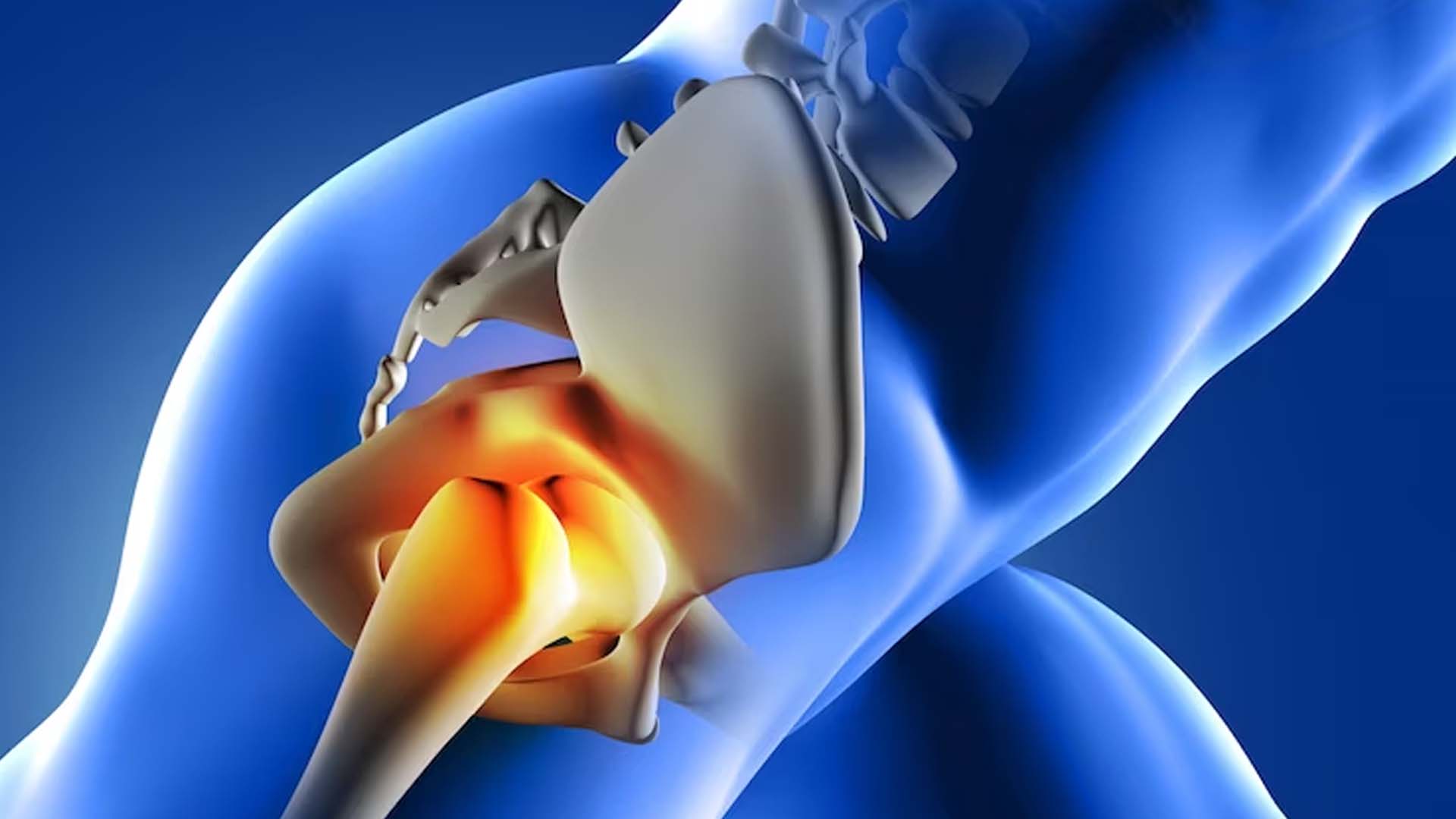 Tight Piriformis Muscle