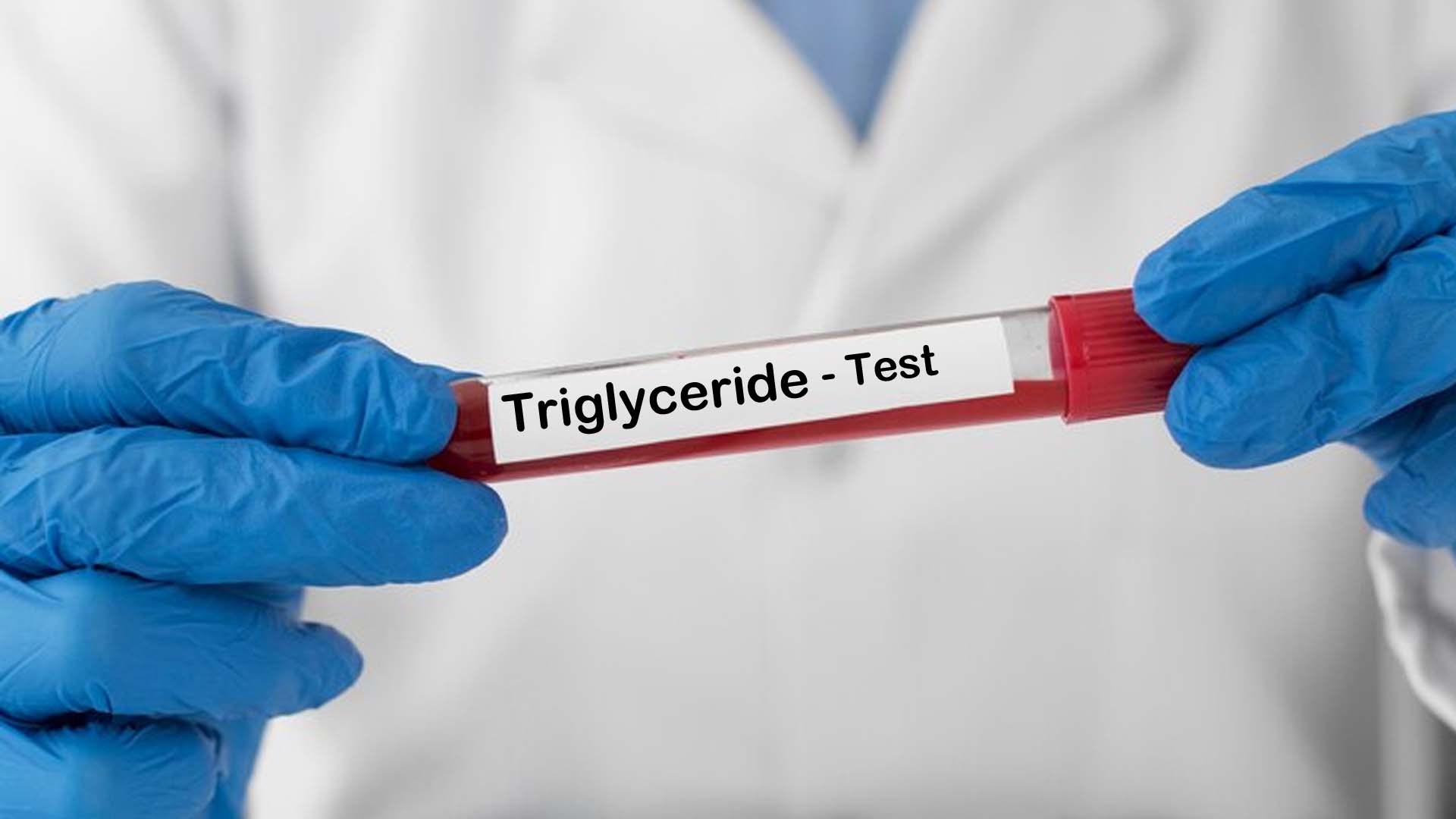 Triglyceride