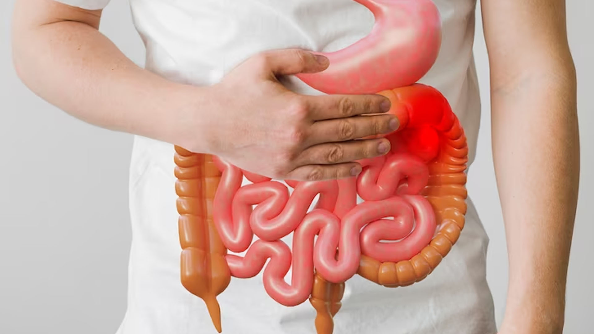 What are the Home Remedies for Ulcerative Colitis?