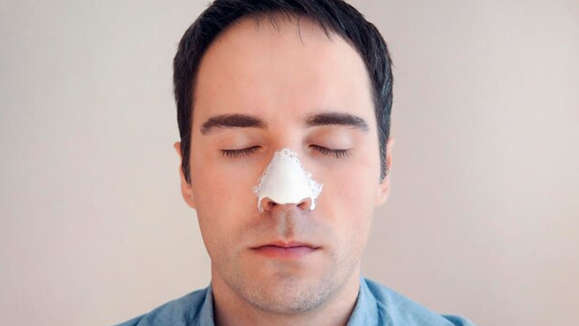What are the Home Remedies for White Heads?