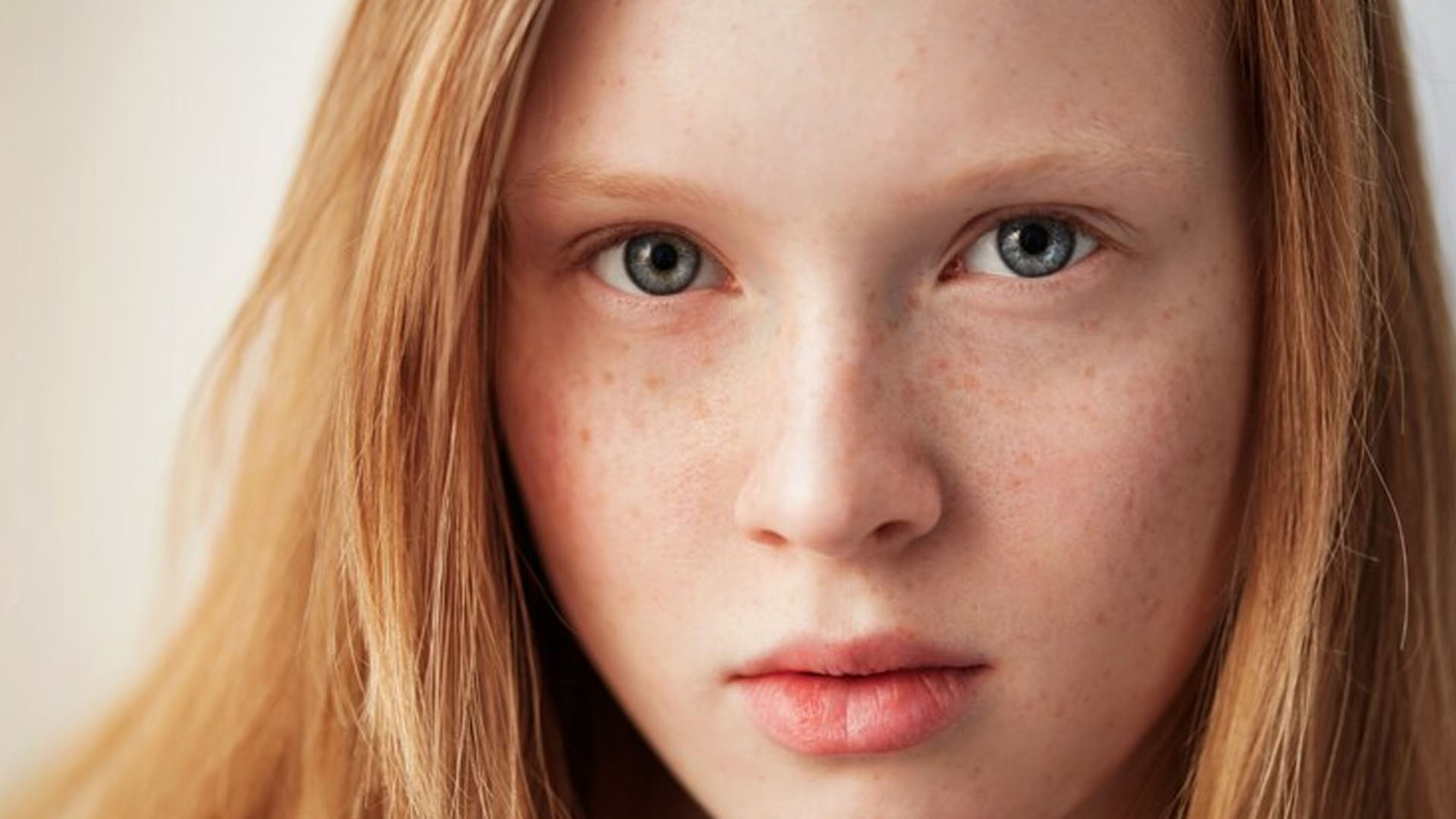 What are the Home Remedies for white spots on Child Face?