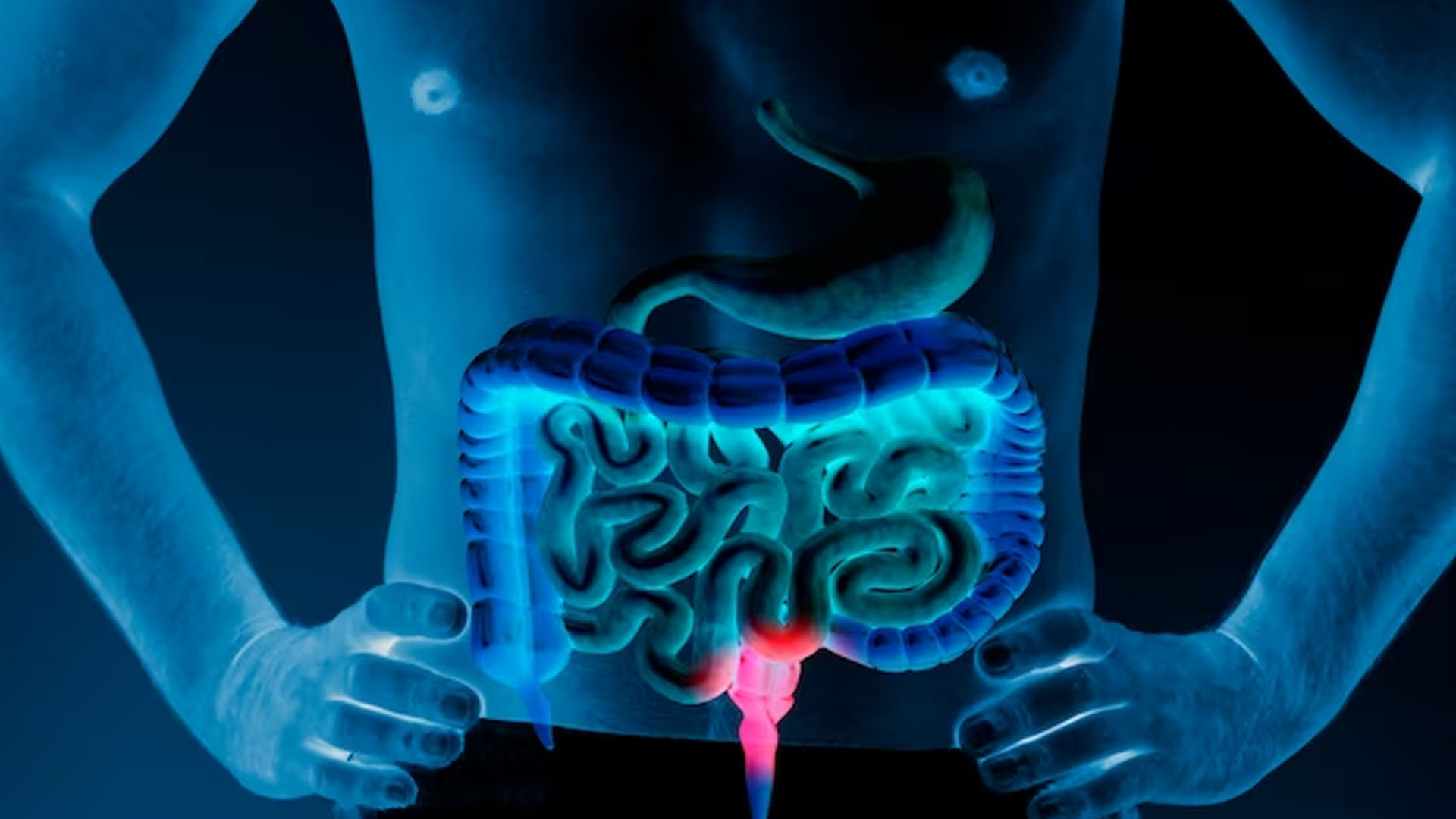 What are the Home Remedies for Colon Cleansing?