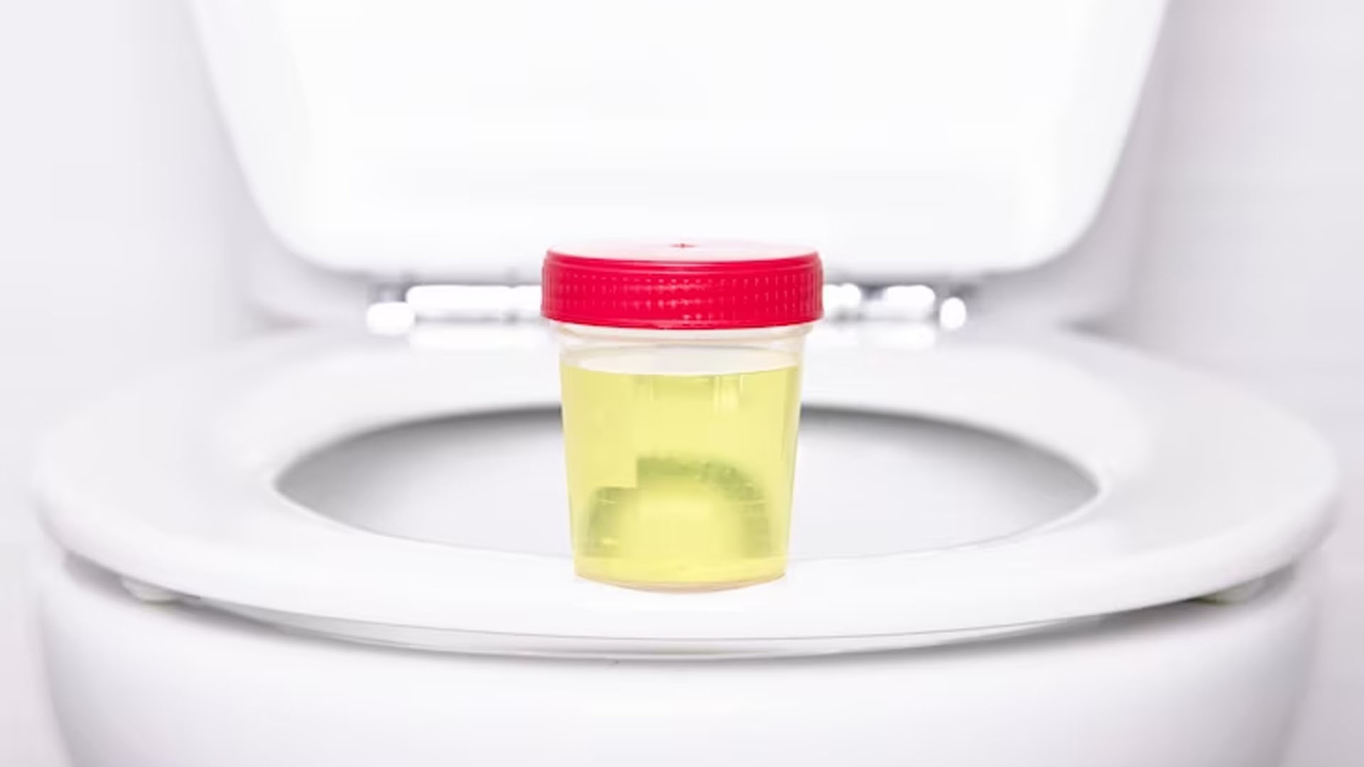 What are the Home Remedies for Foamy Urine?