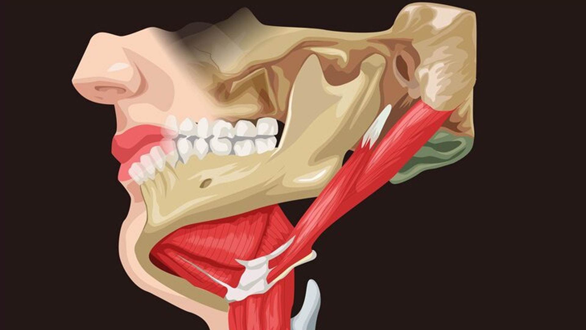 What are the Home Remedies for Frenulum Tear?