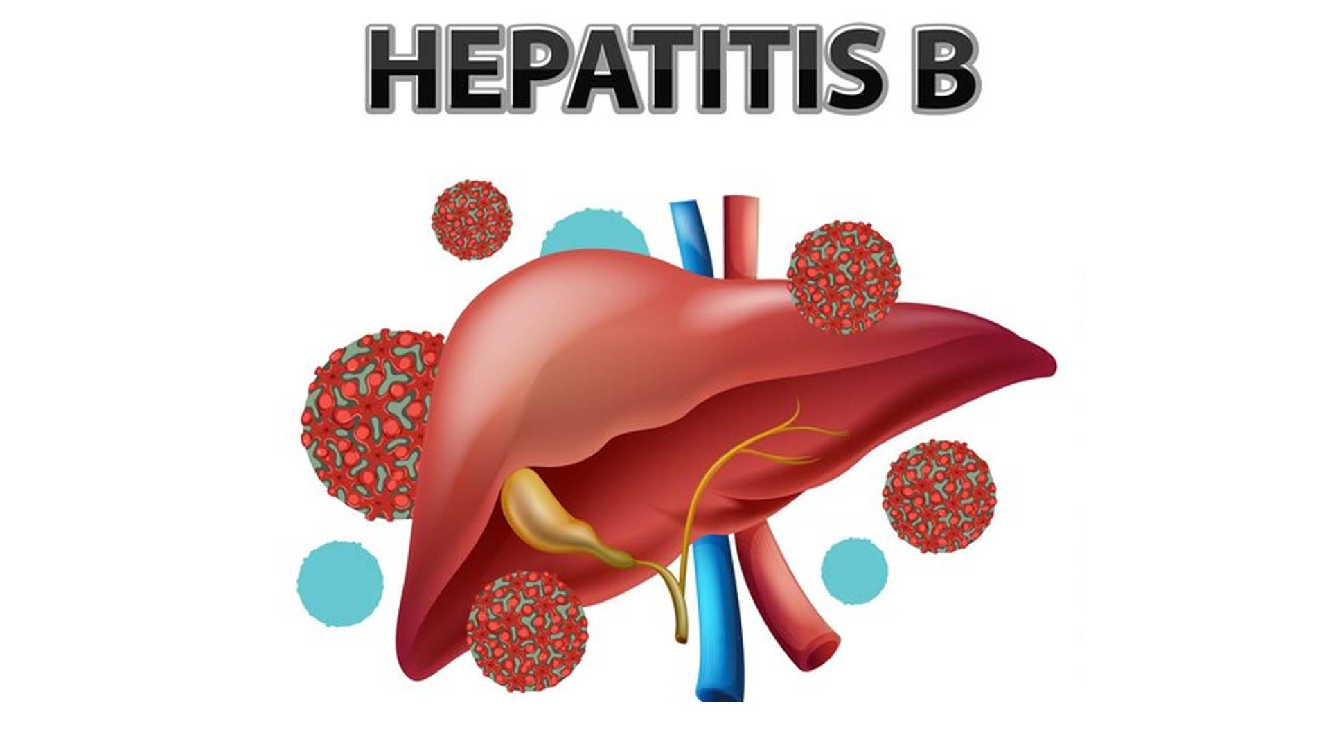 Hepatitis B