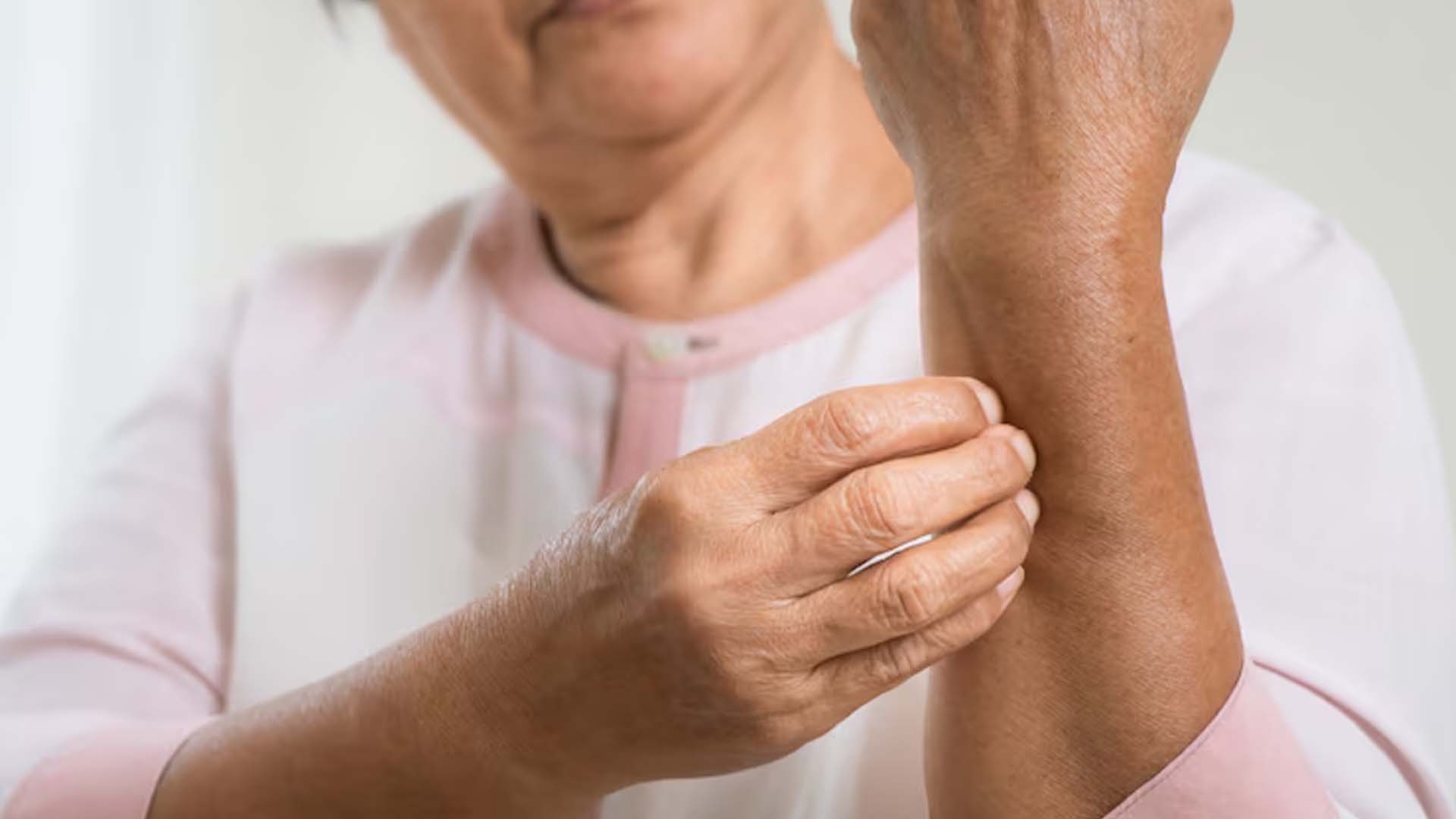 Itchy Skin in the Elderly