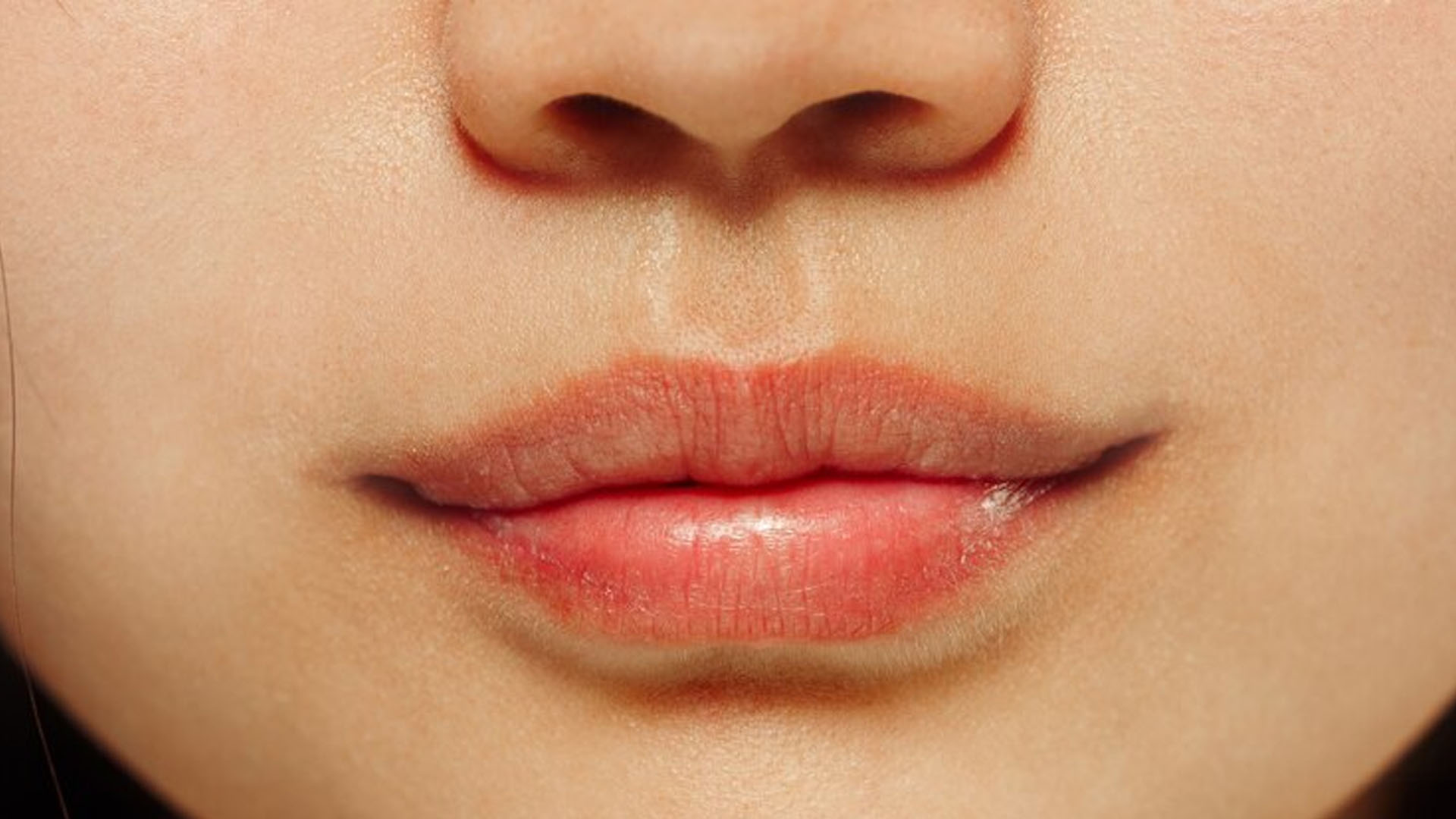 What are the Home Remedies for Lip Eczema?