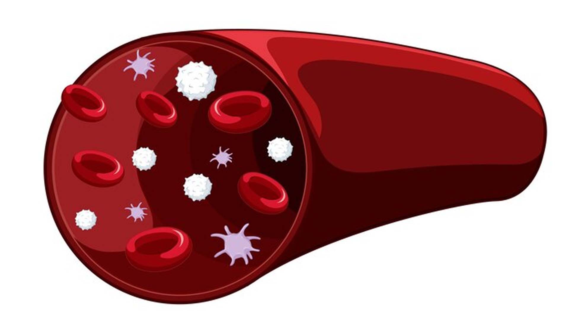 Low blood platelet count