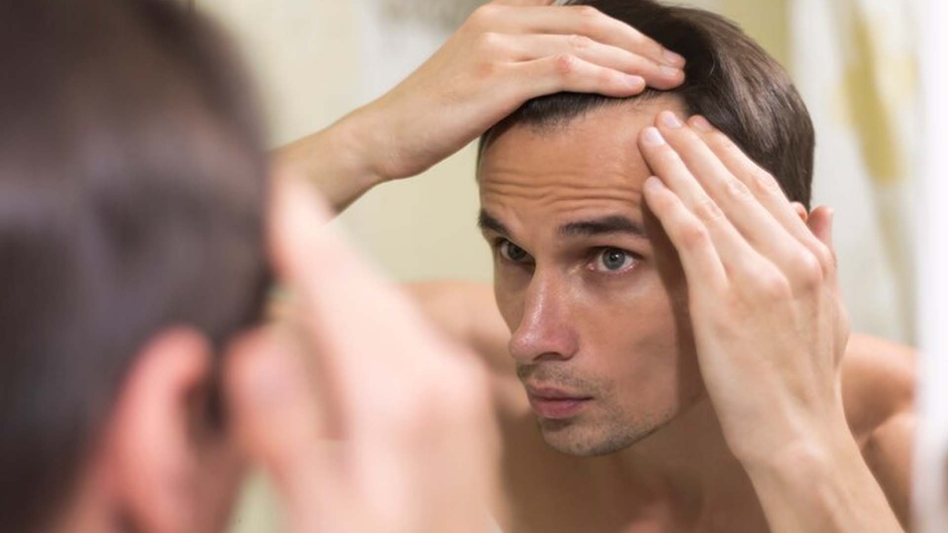 Male Hair Loss