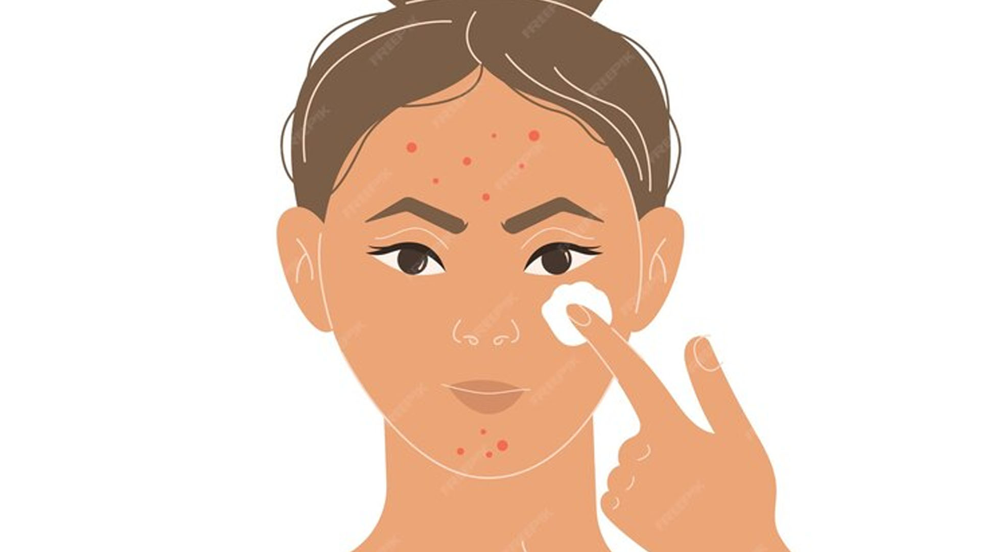 What are the Home Remedies for Mole Removal on Face?