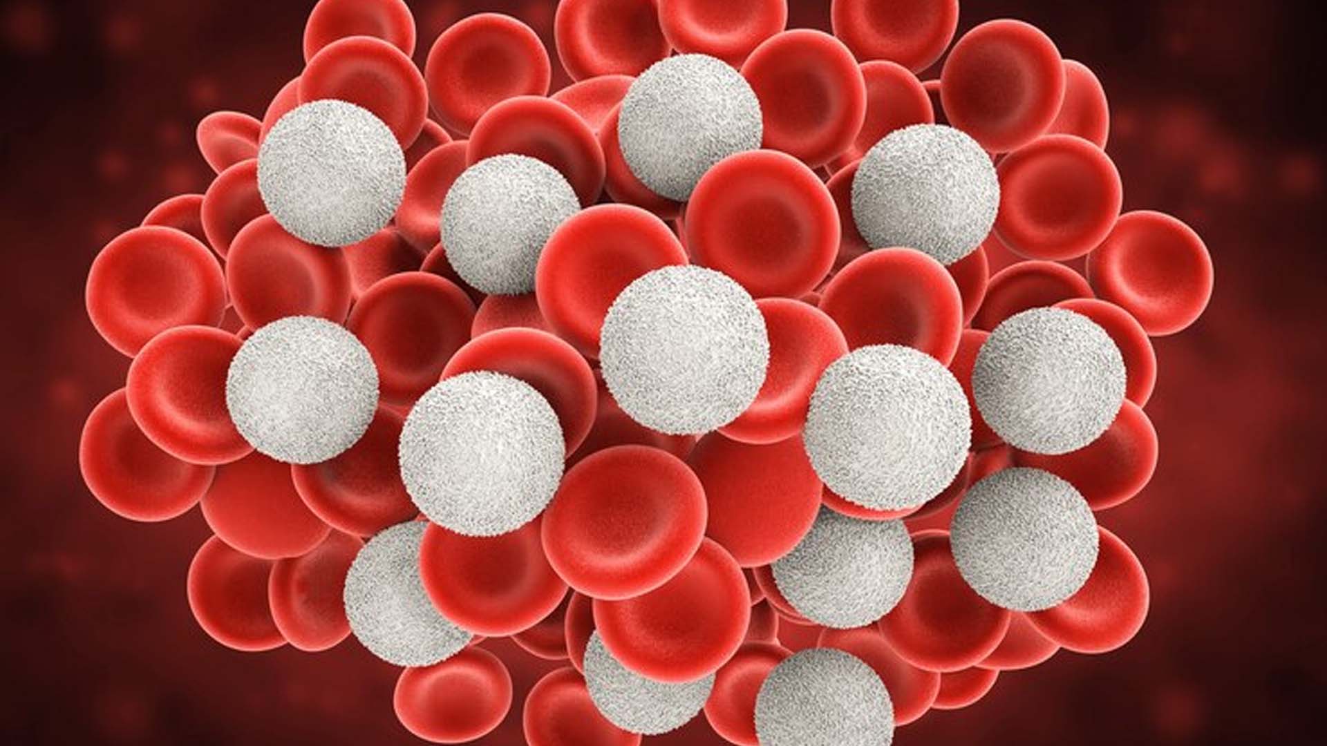Increased white blood cell (WBC) count
