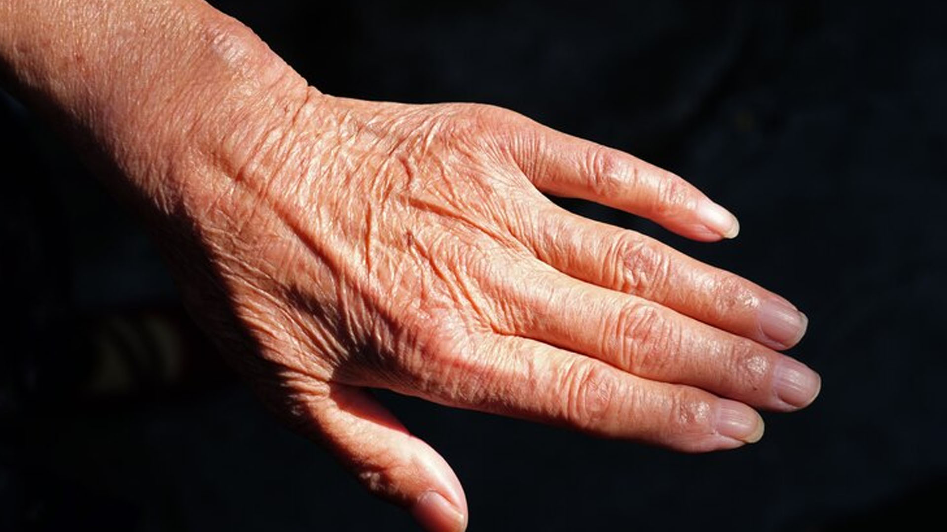 What are the Home Remedies for Wrinkled Hands?