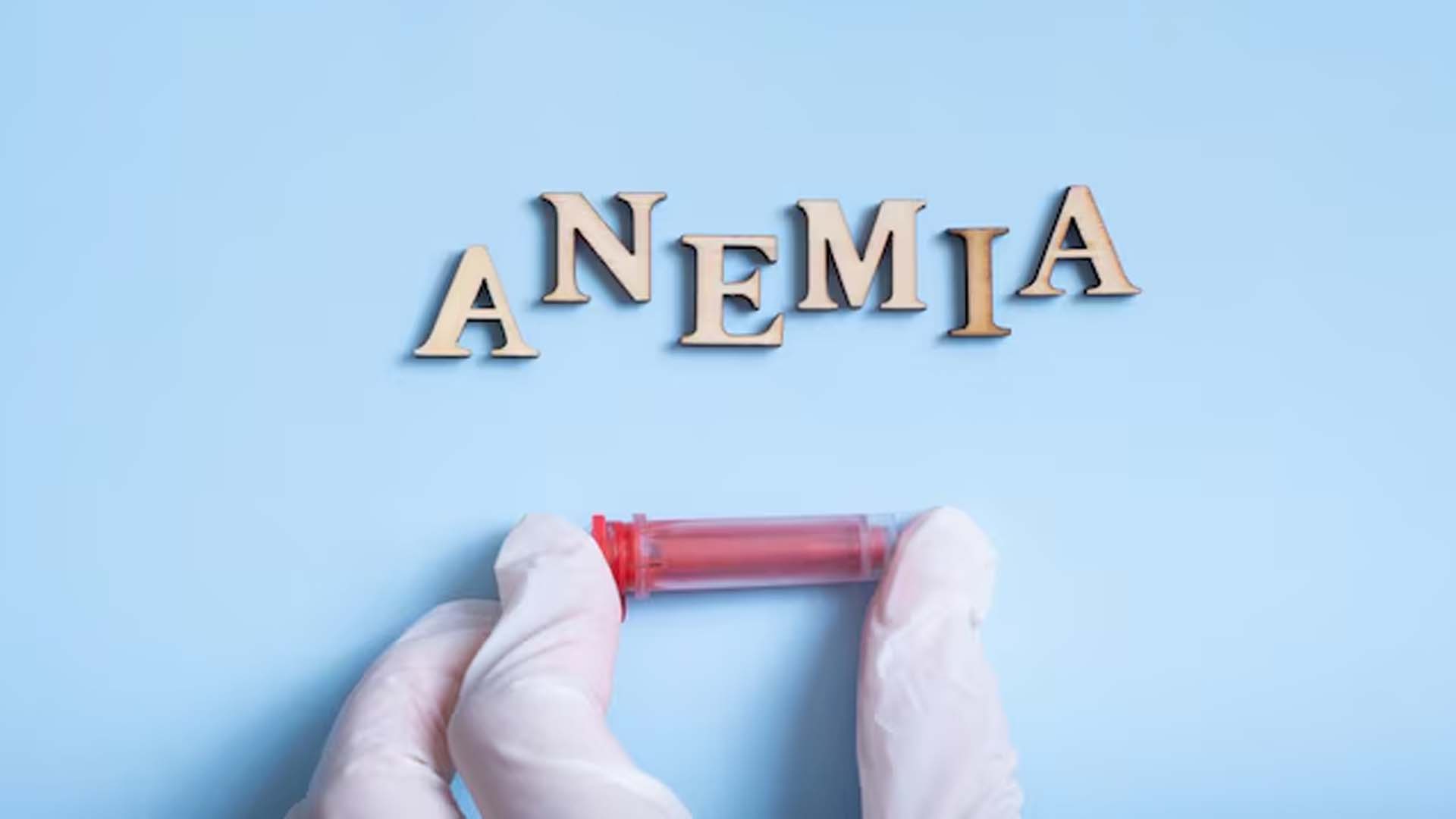 Anemia