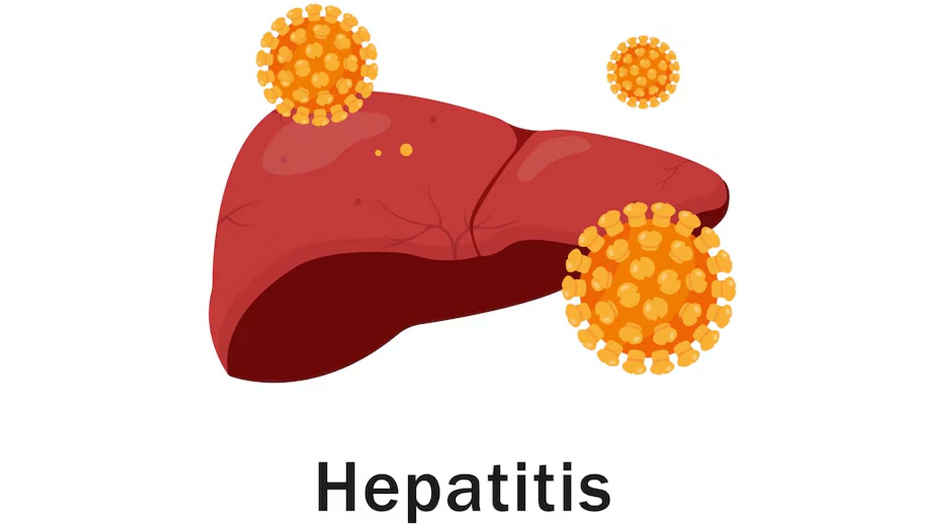 Hepatitis