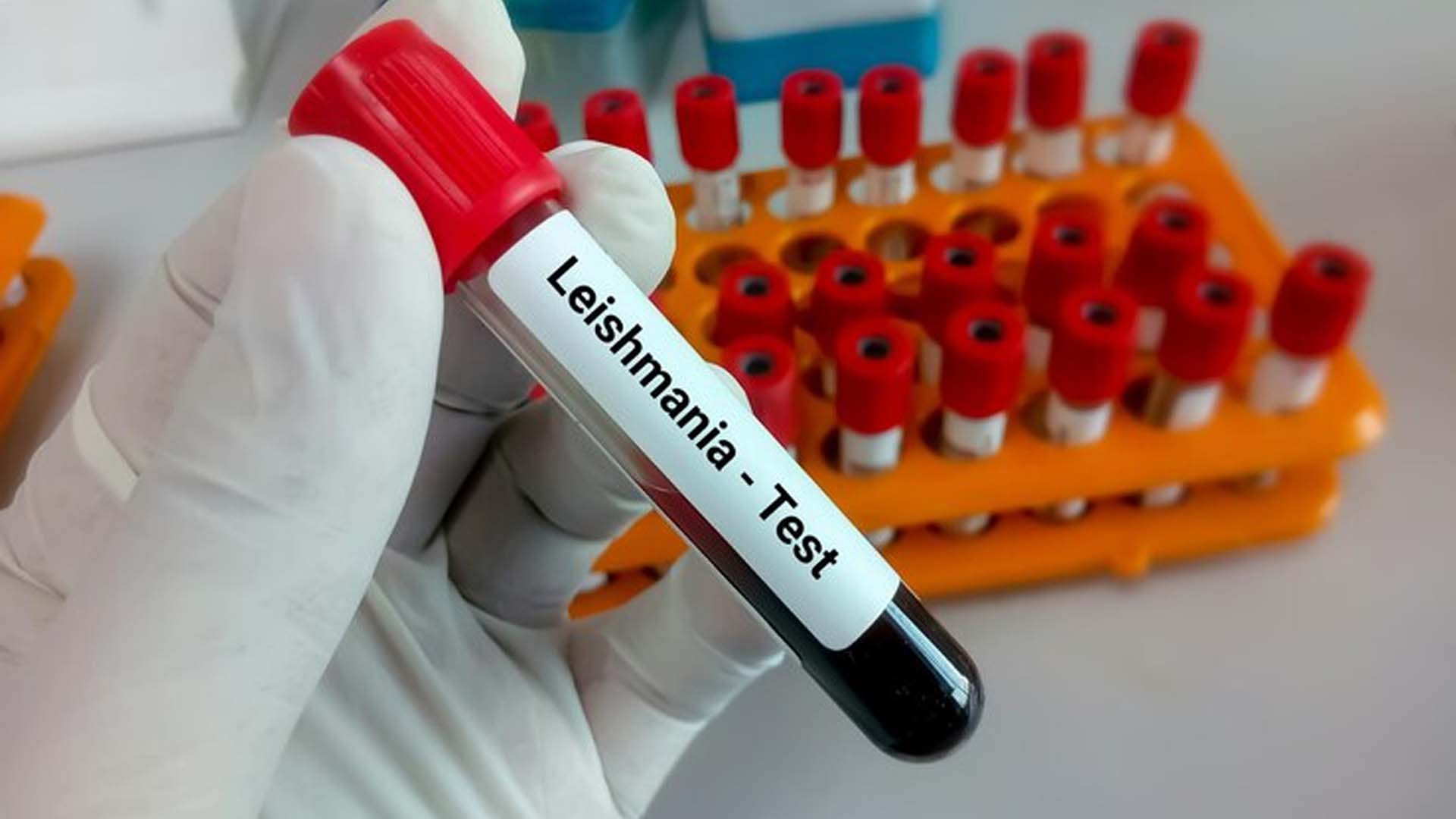 Leishmania