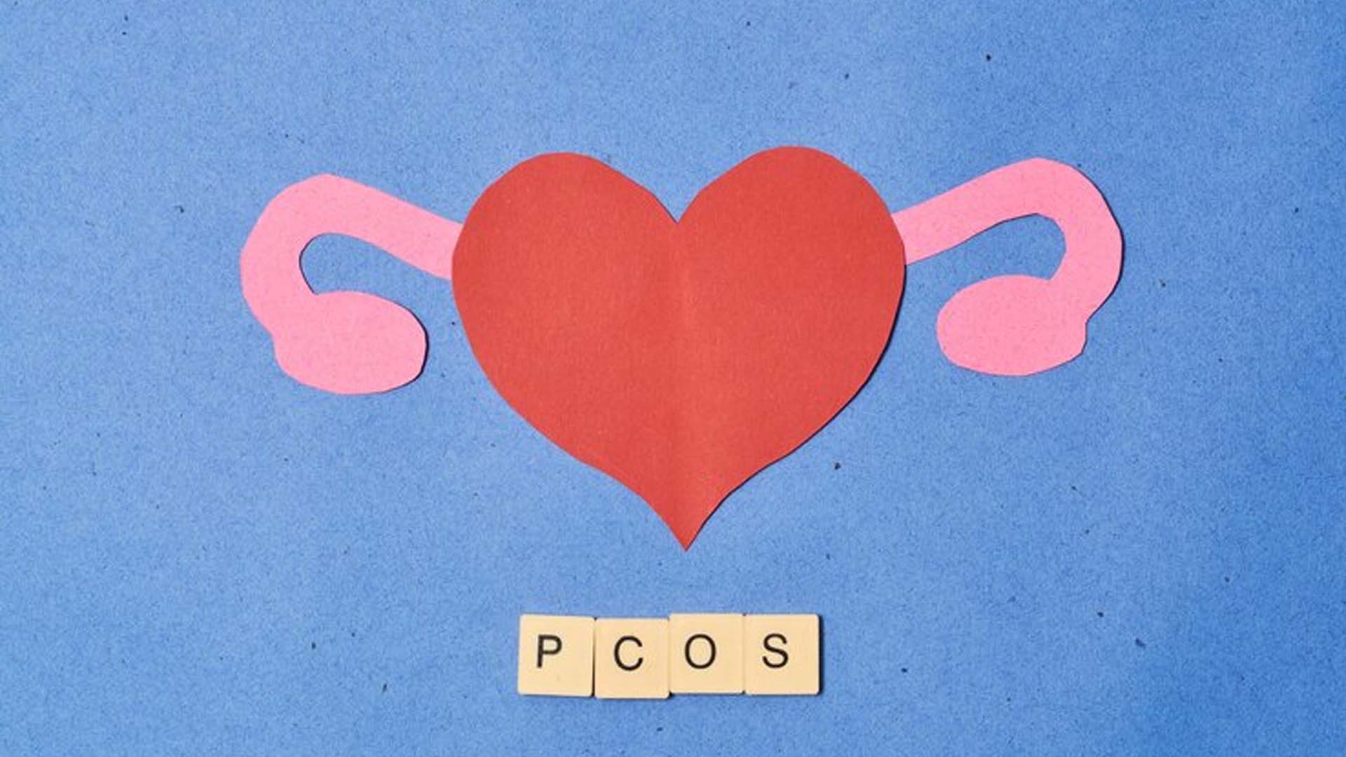 Polycystic ovary syndrome (PCOS)