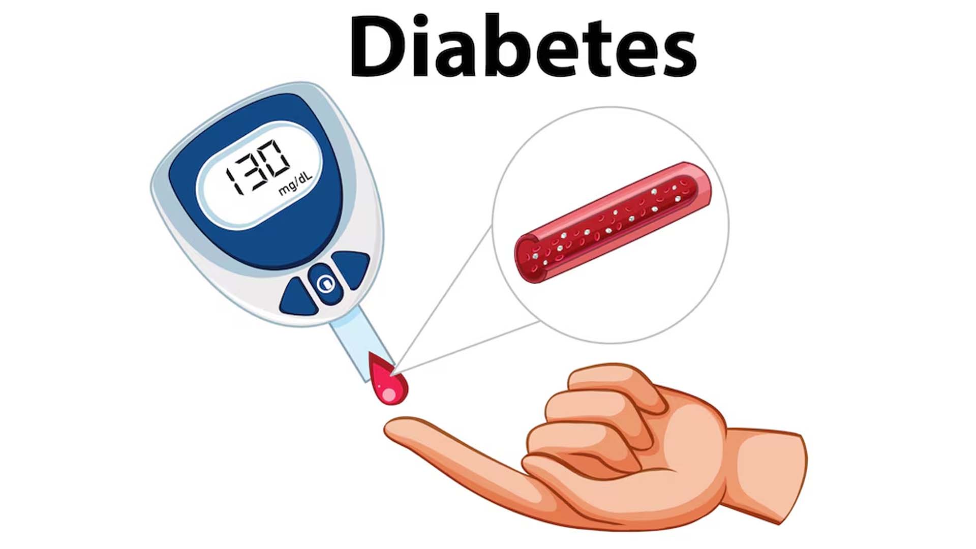 Diabetes
