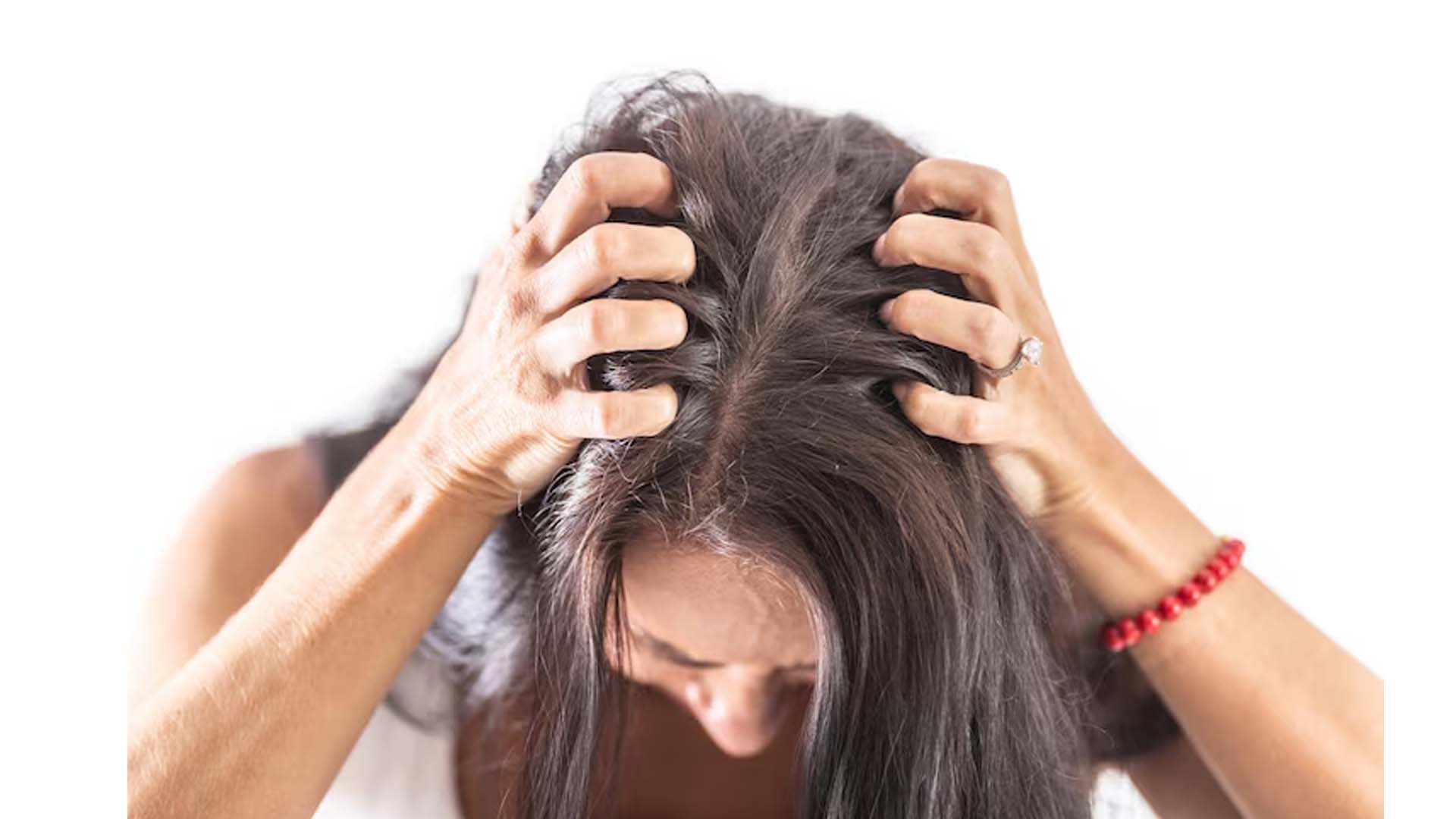 Itchy Scalp